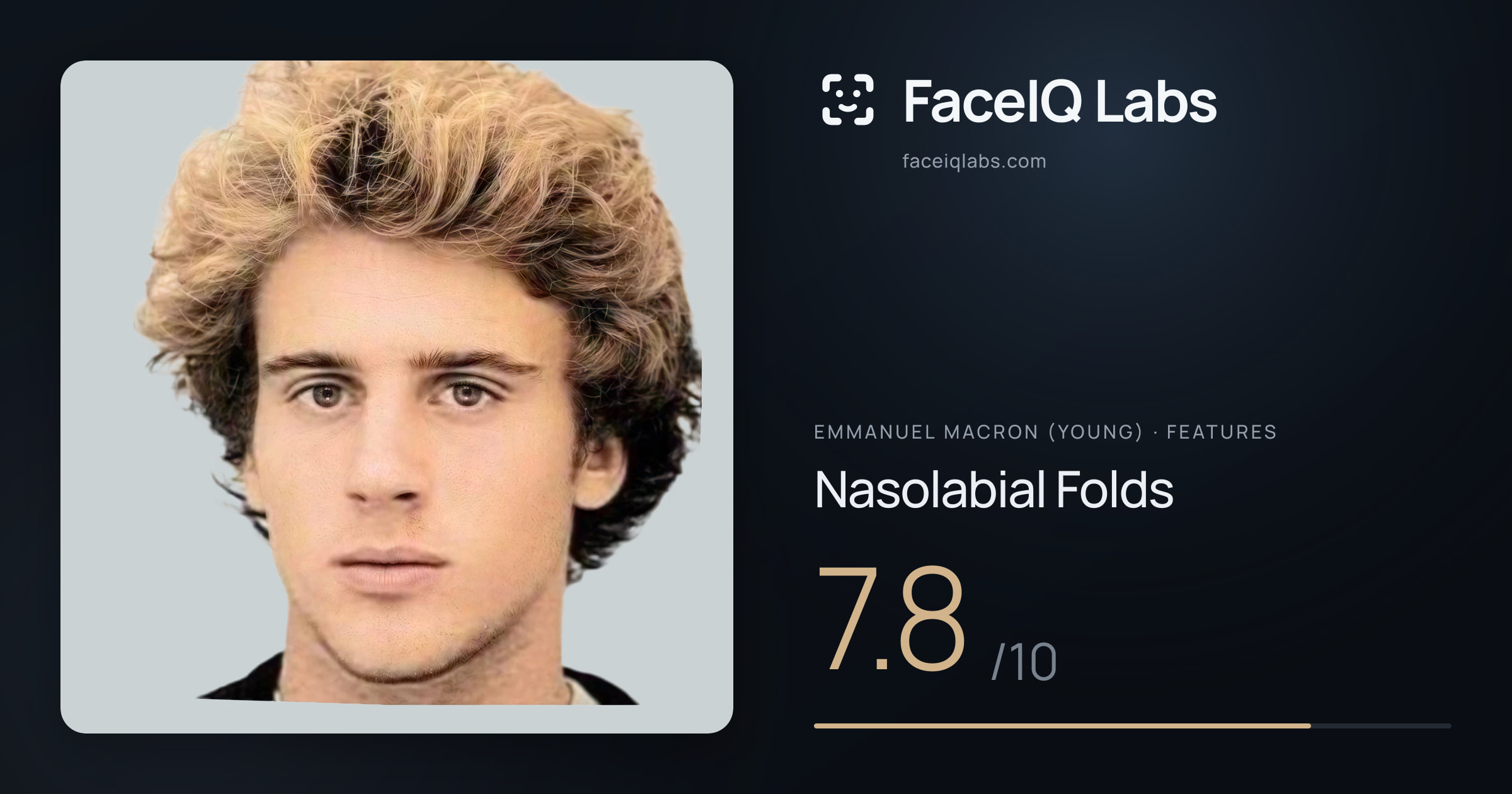 Emmanuel Macron (Young) Nasolabial Folds: 7.8/10, drawn on the photo