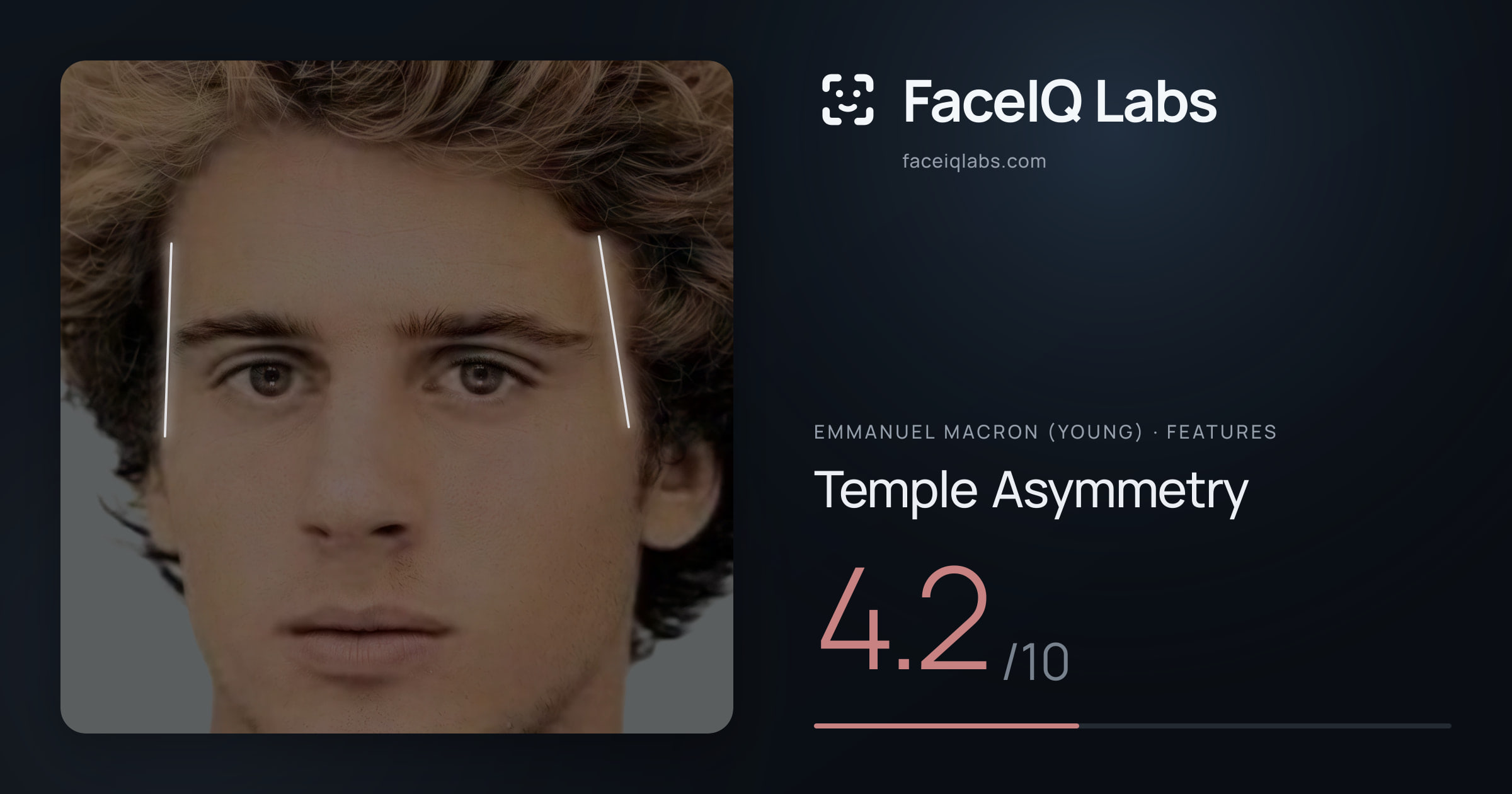 Emmanuel Macron (Young) Temple Asymmetry: 4.2/10, drawn on the photo