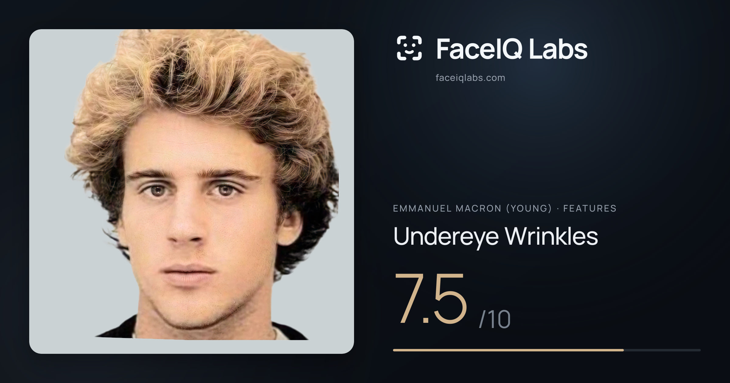Emmanuel Macron (Young) Undereye Wrinkles: 7.5/10, drawn on the photo