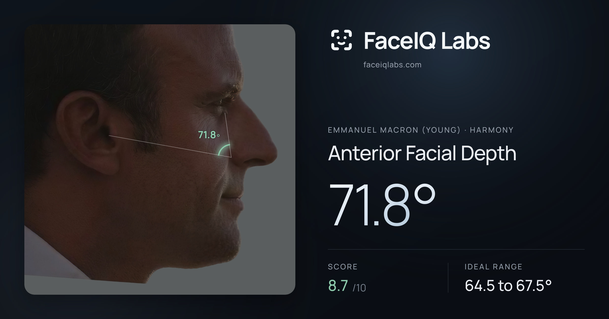 Emmanuel Macron (Young) Anterior Facial Depth: 71.8°, drawn on the photo