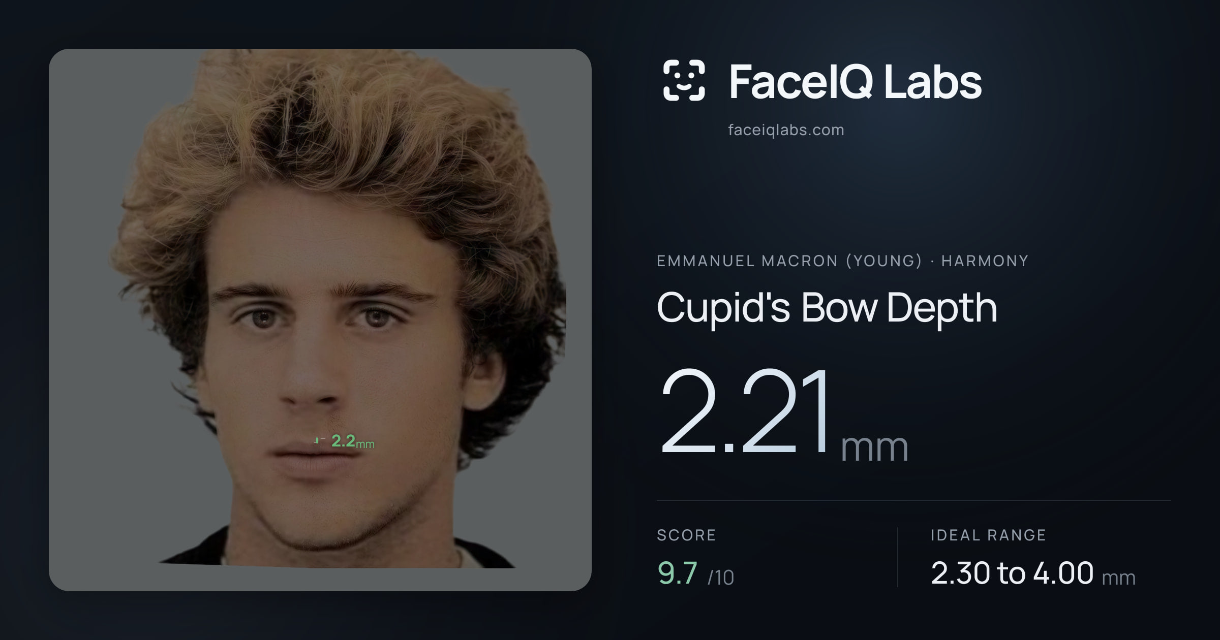 Emmanuel Macron (Young) Cupid's Bow Depth: 2.21mm, drawn on the photo