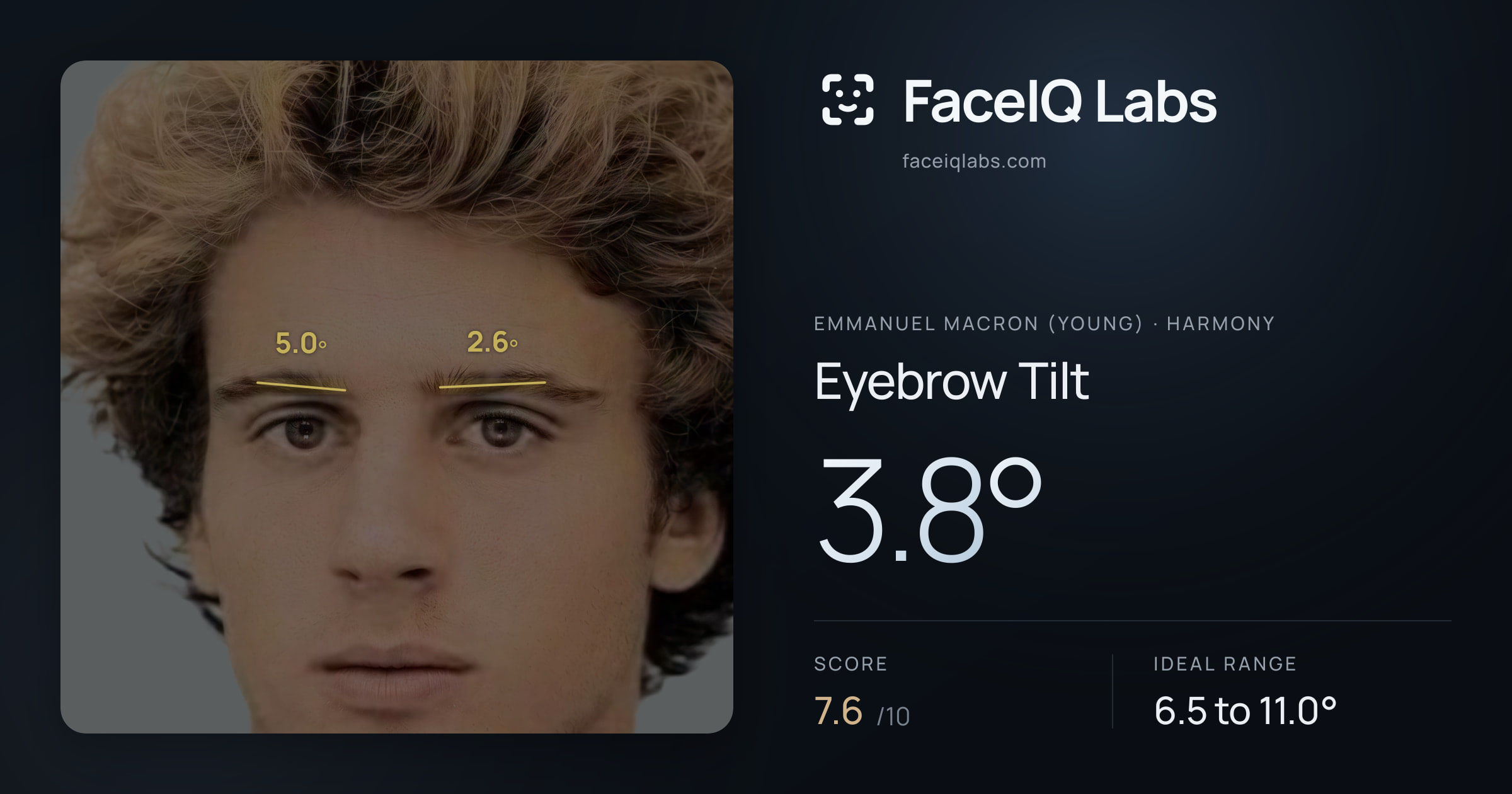 Emmanuel Macron (Young) Eyebrow Tilt: 3.8°, drawn on the photo