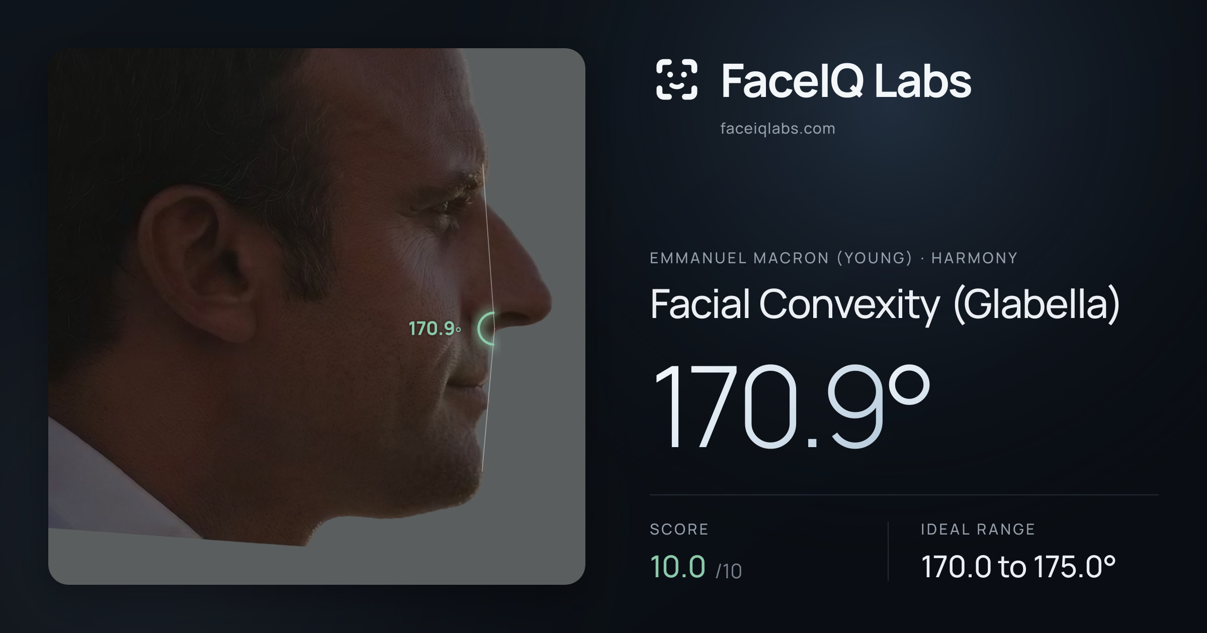 Emmanuel Macron (Young) Facial Convexity (Glabella): 170.9°, drawn on the photo