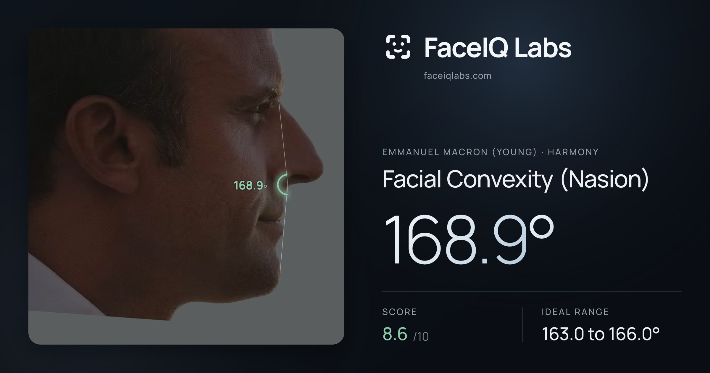 Emmanuel Macron (Young) Facial Convexity (Nasion): 168.9°, drawn on the photo