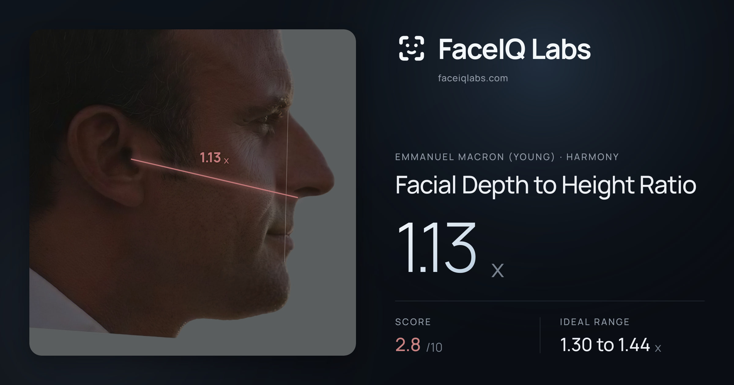 Emmanuel Macron (Young) Facial Depth to Height Ratio: 1.13x, drawn on the photo