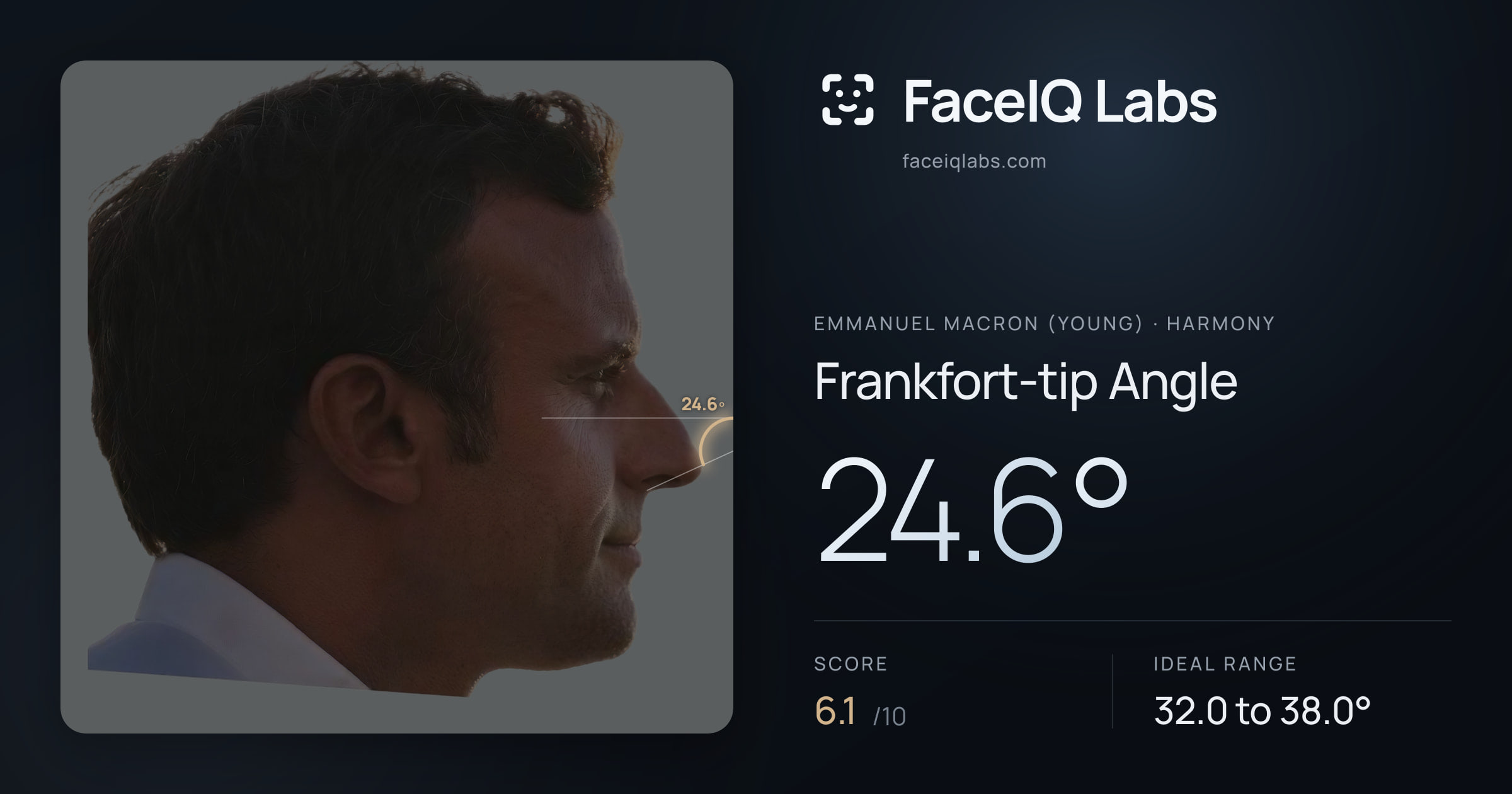Emmanuel Macron (Young) Frankfort-tip Angle: 24.6°, drawn on the photo