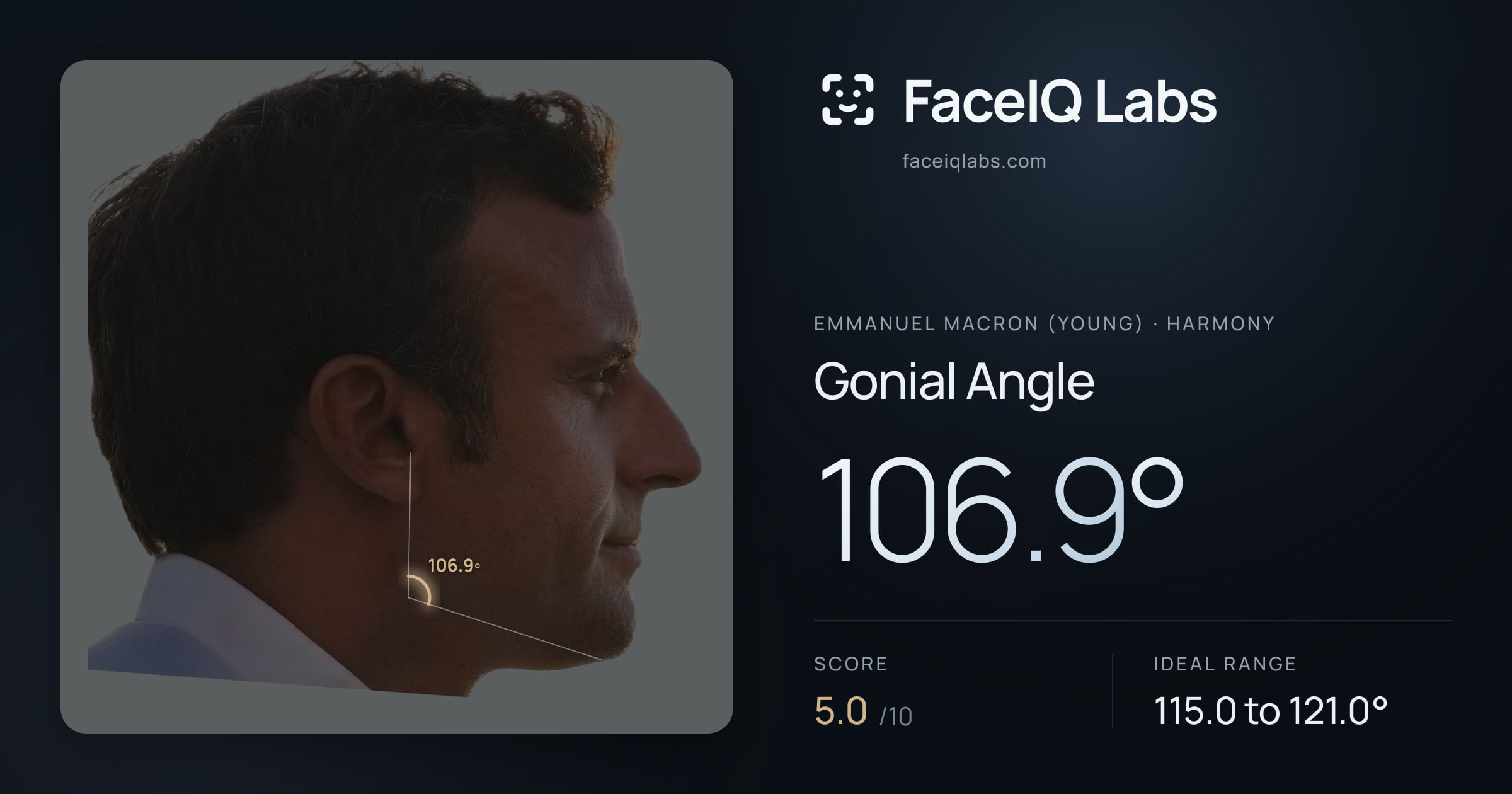 Emmanuel Macron (Young) Gonial Angle: 106.9°, drawn on the photo
