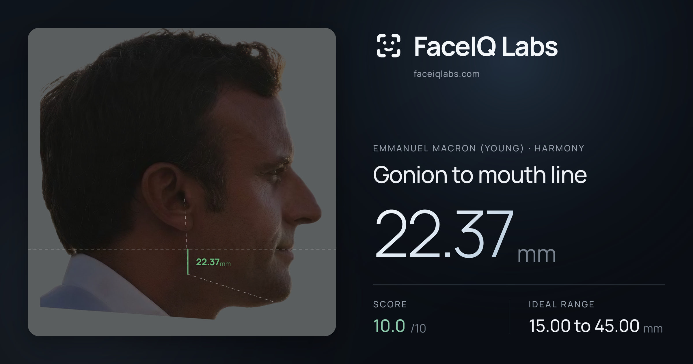 Emmanuel Macron (Young) Gonion to mouth line: 22.37mm, drawn on the photo
