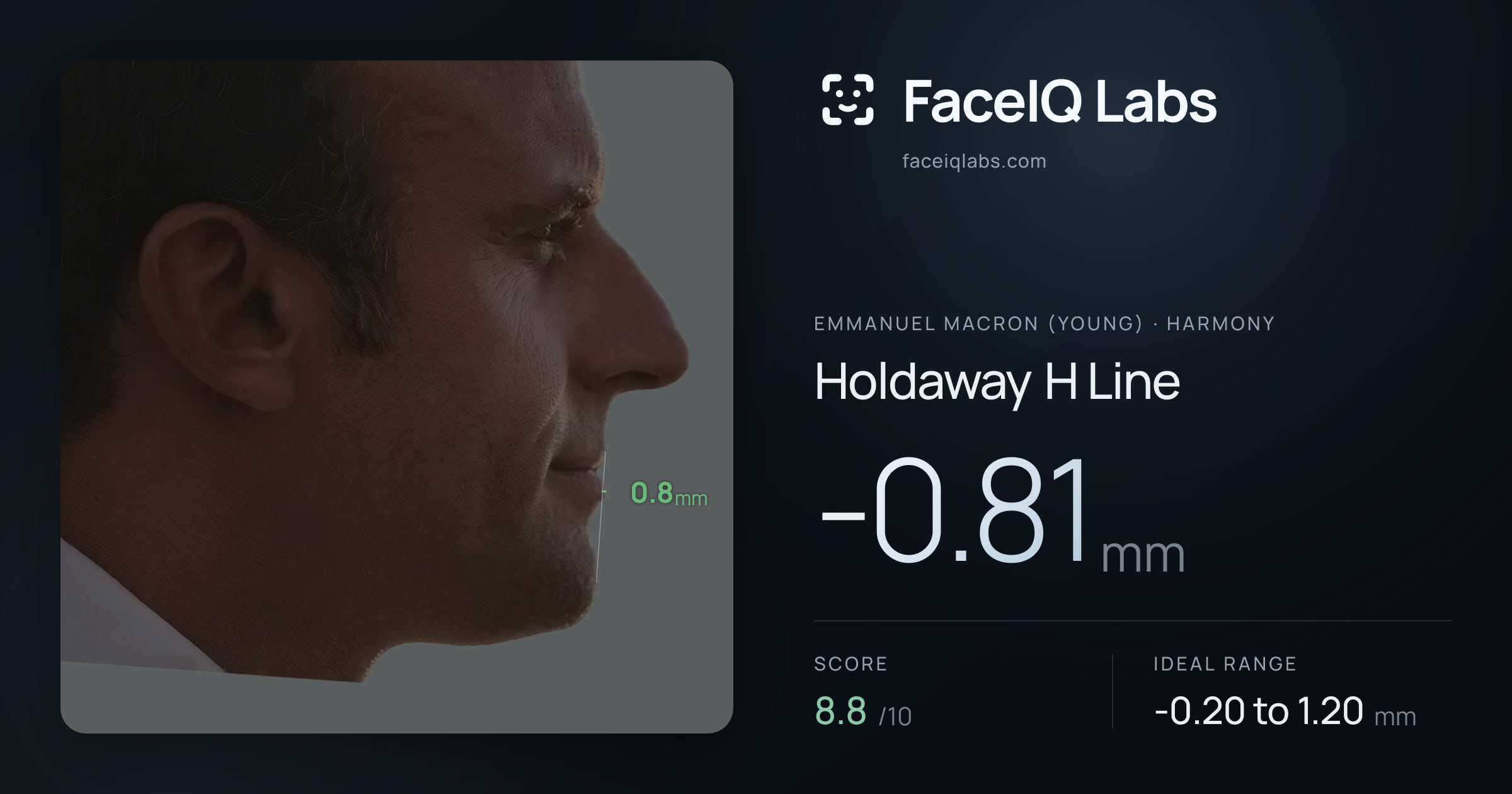 Emmanuel Macron (Young) Holdaway H Line: -0.81mm, drawn on the photo