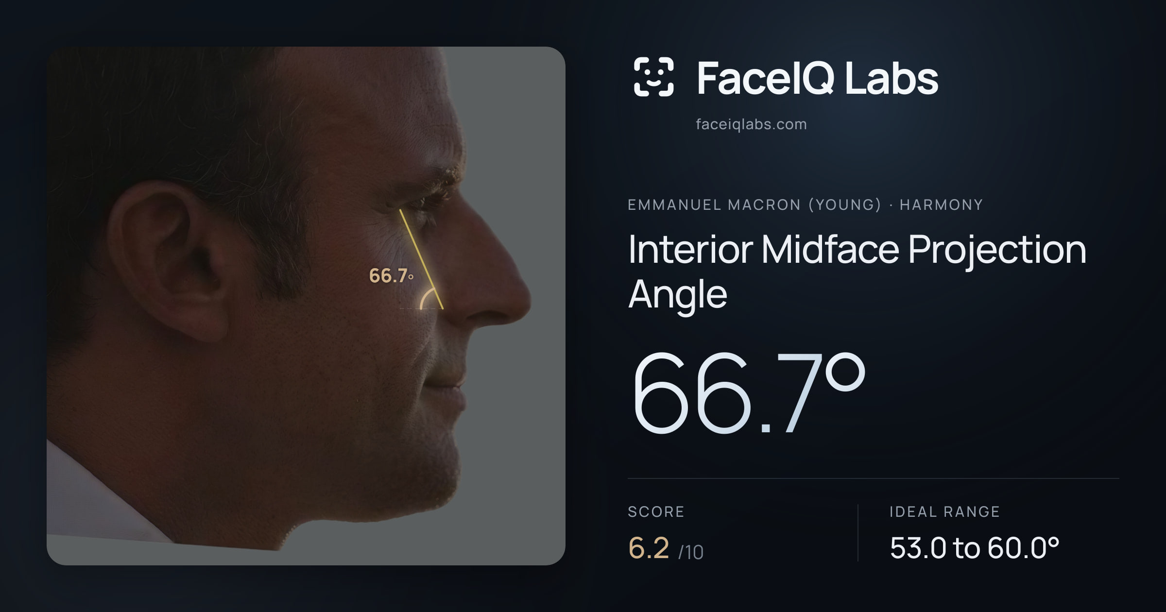 Emmanuel Macron (Young) Interior Midface Projection Angle: 66.7°, drawn on the photo