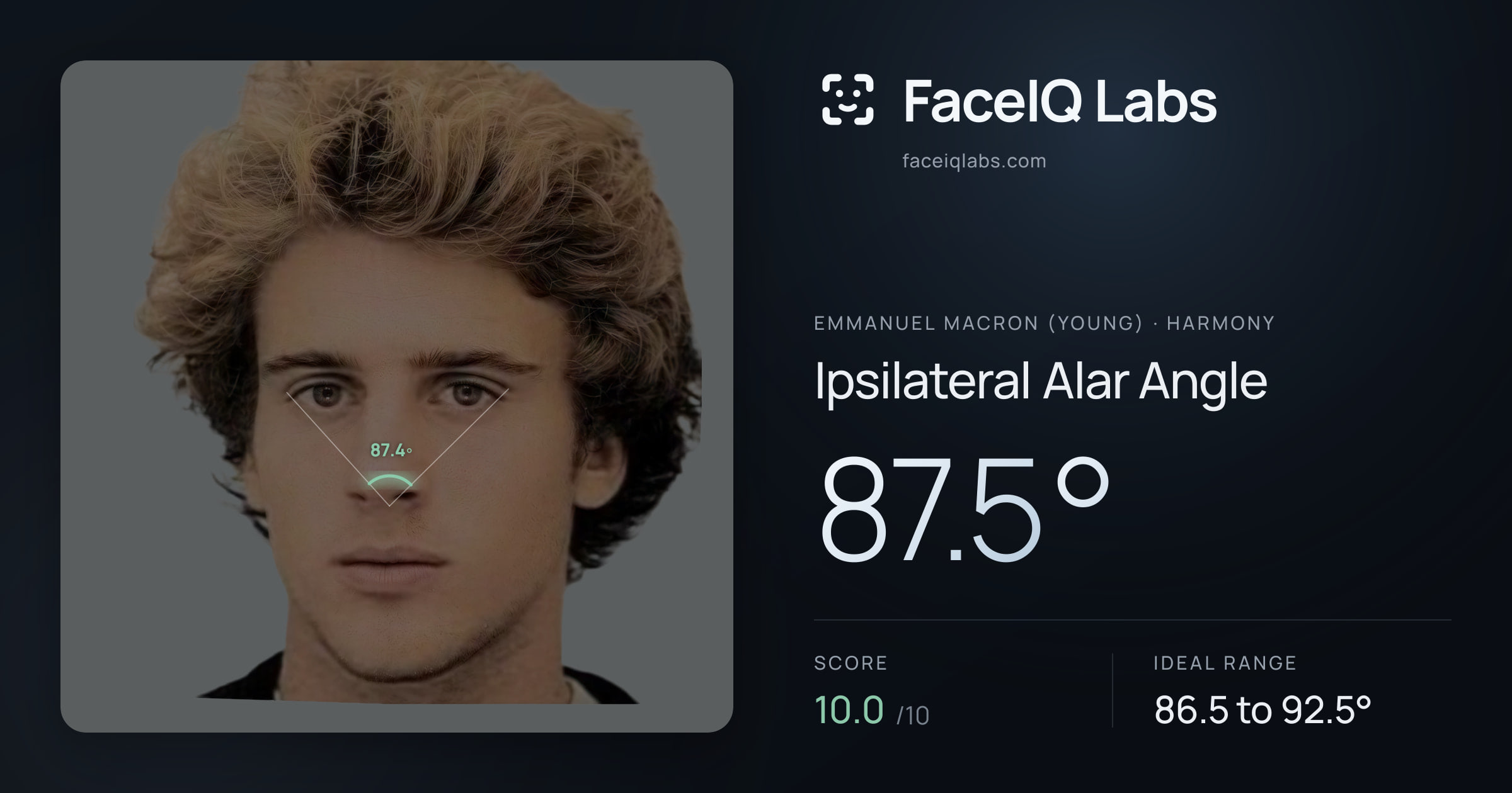 Emmanuel Macron (Young) Ipsilateral Alar Angle: 87.5°, drawn on the photo