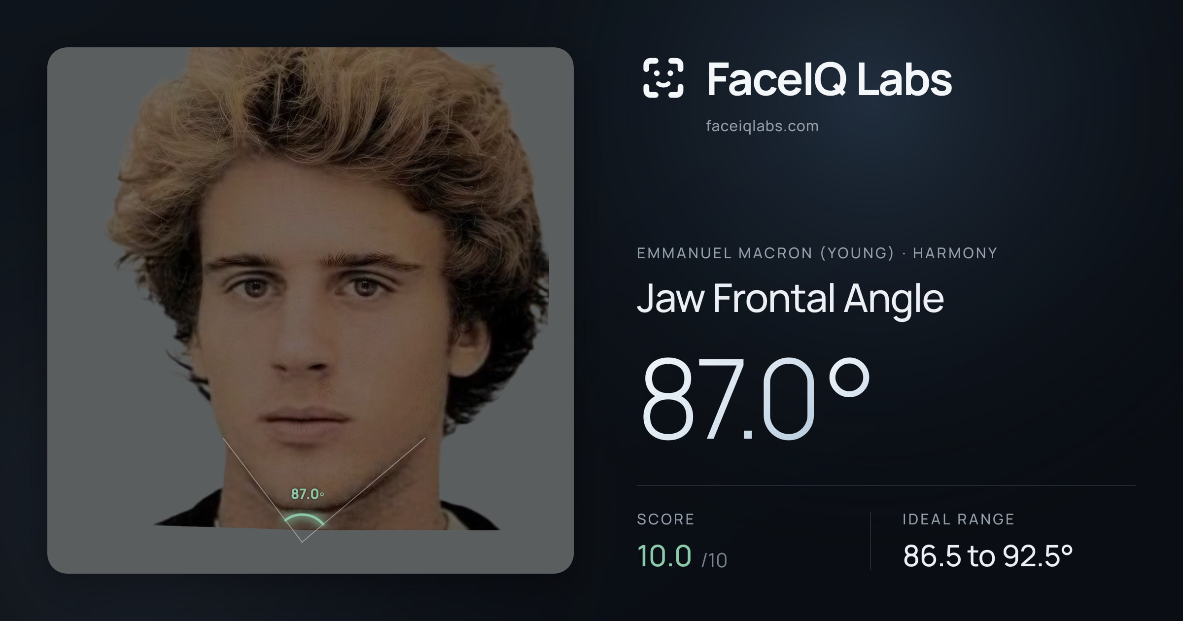 Emmanuel Macron (Young) Jaw Frontal Angle: 87.0°, drawn on the photo