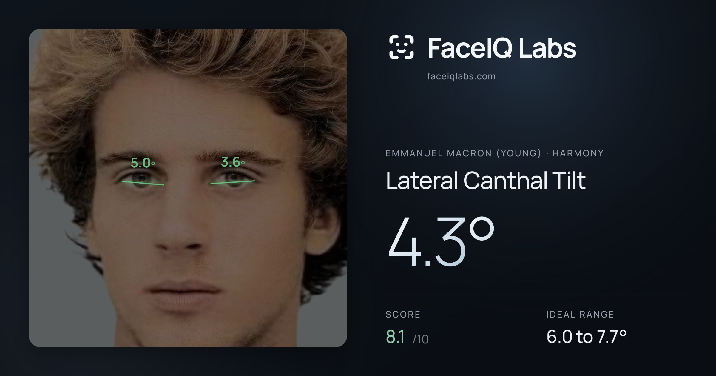Emmanuel Macron (Young) Lateral Canthal Tilt: 4.3°, drawn on the photo