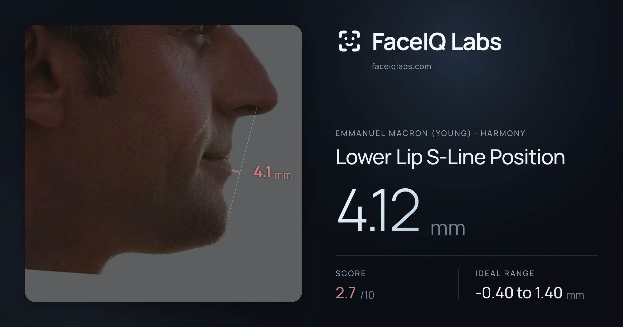 Emmanuel Macron (Young) Lower Lip S-Line Position: 4.12mm, drawn on the photo