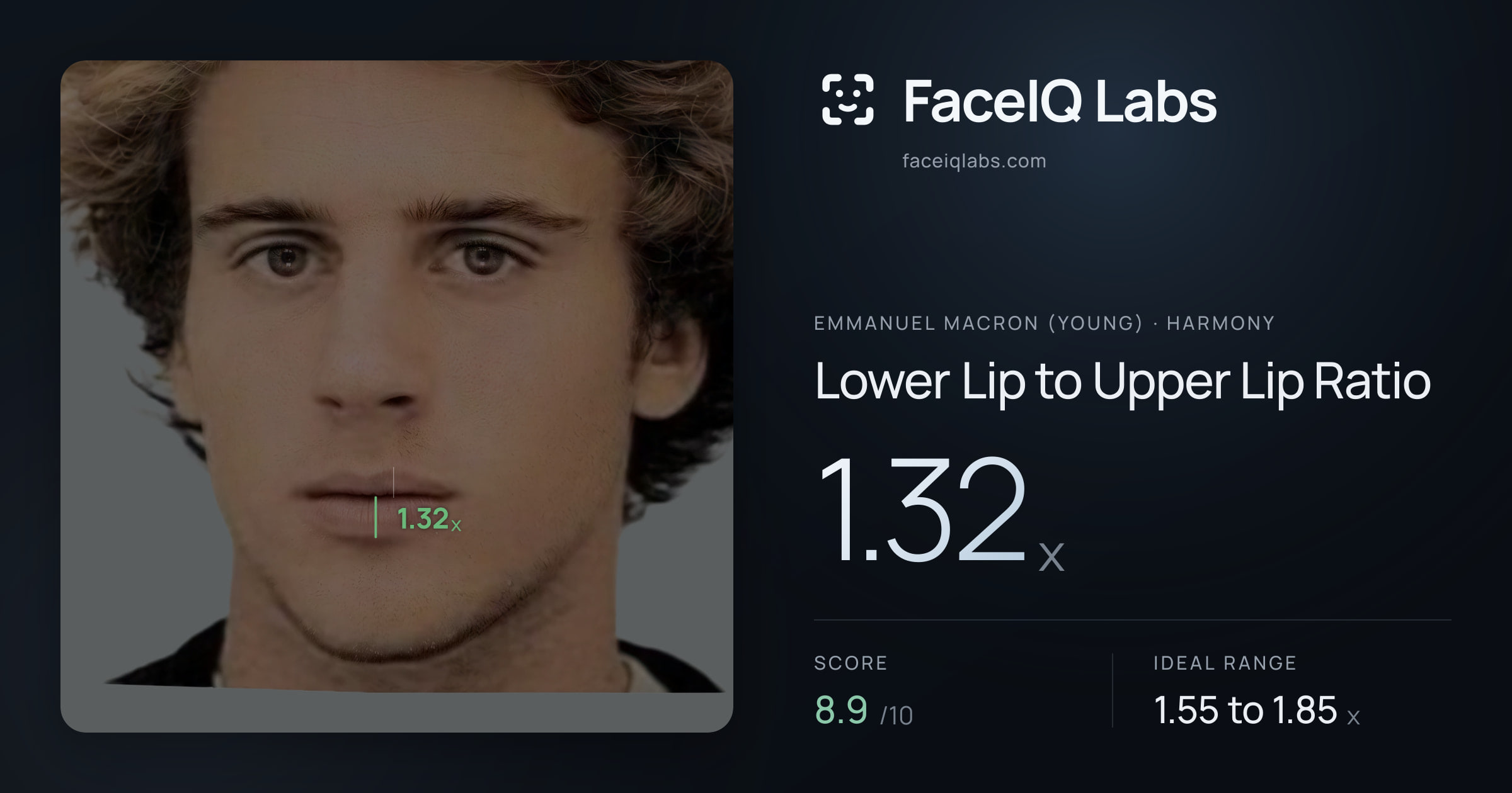 Emmanuel Macron (Young) Lower Lip to Upper Lip Ratio: 1.32x, drawn on the photo