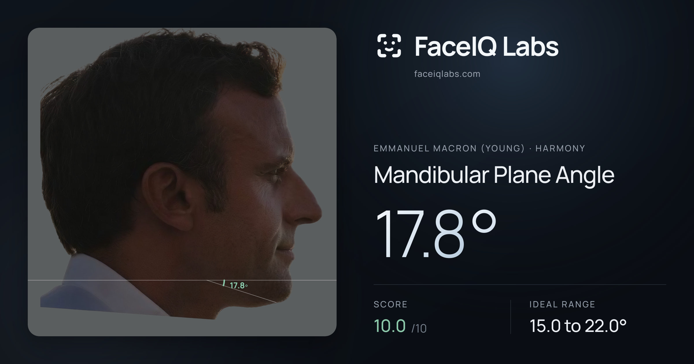 Emmanuel Macron (Young) Mandibular Plane Angle: 17.8°, drawn on the photo