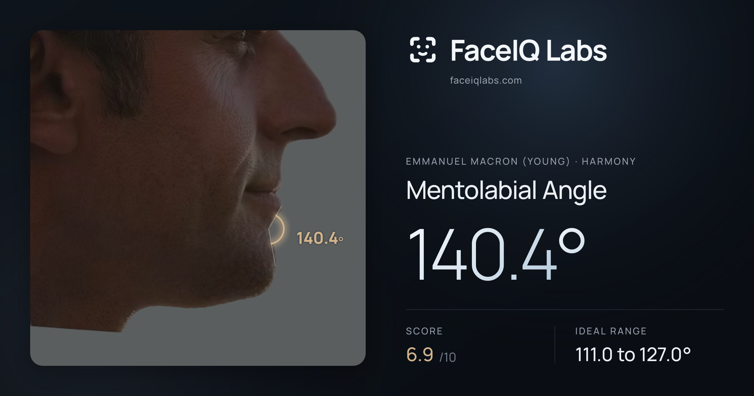 Emmanuel Macron (Young) Mentolabial Angle: 140.4°, drawn on the photo