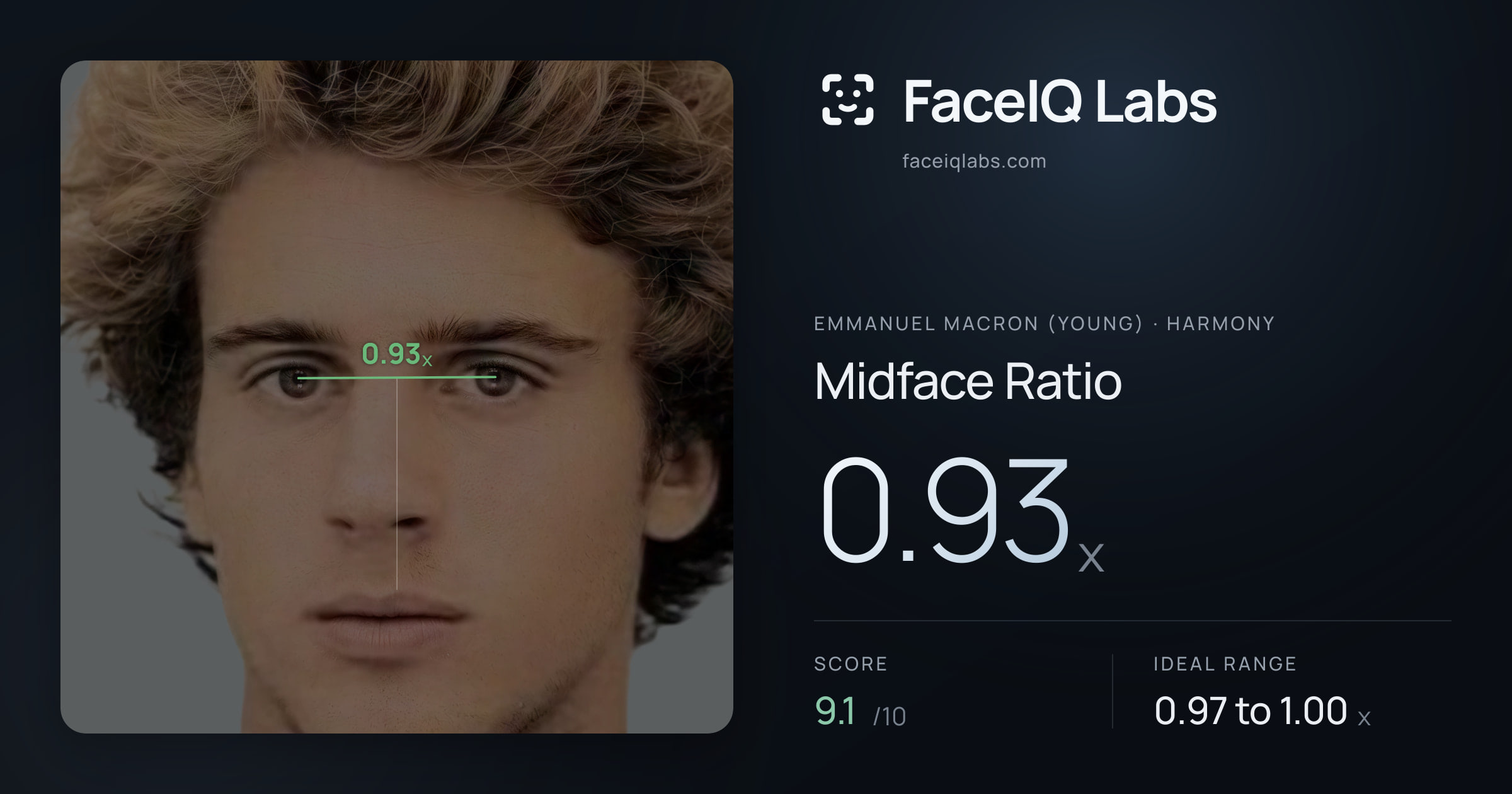 Emmanuel Macron (Young) Midface Ratio: 0.93x, drawn on the photo