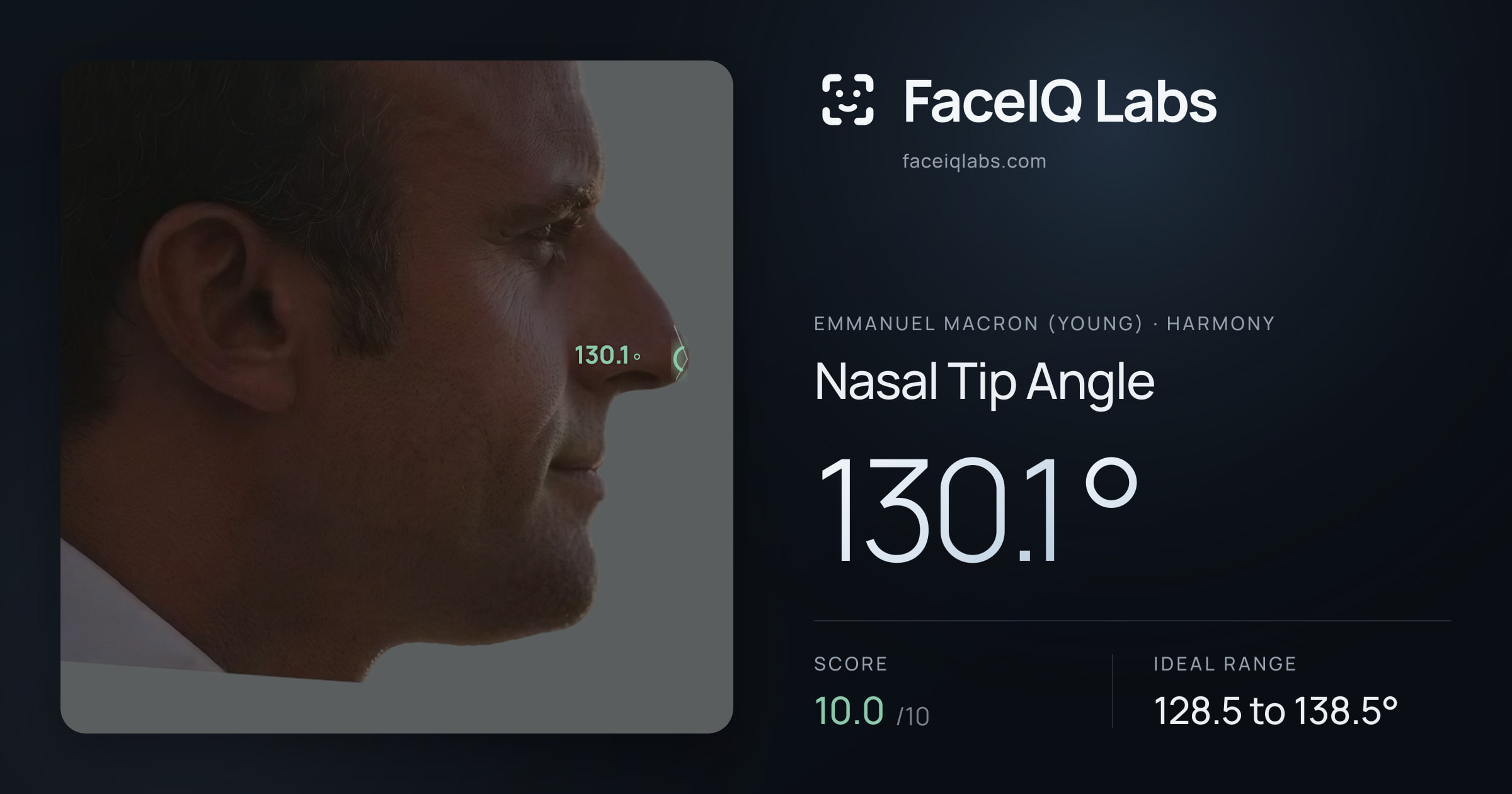 Emmanuel Macron (Young) Nasal Tip Angle: 130.1°, drawn on the photo
