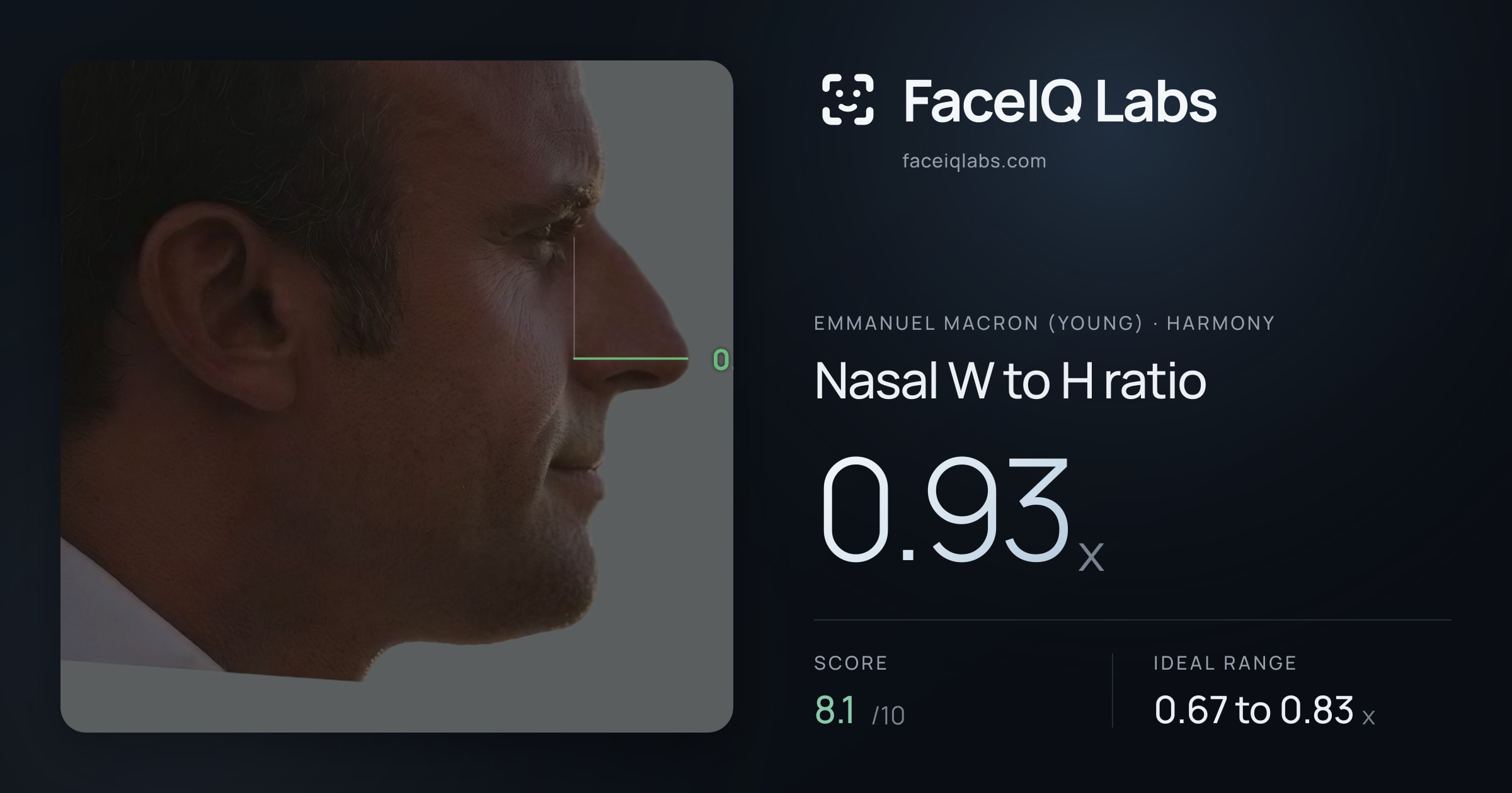 Emmanuel Macron (Young) Nasal W to H ratio: 0.93x, drawn on the photo