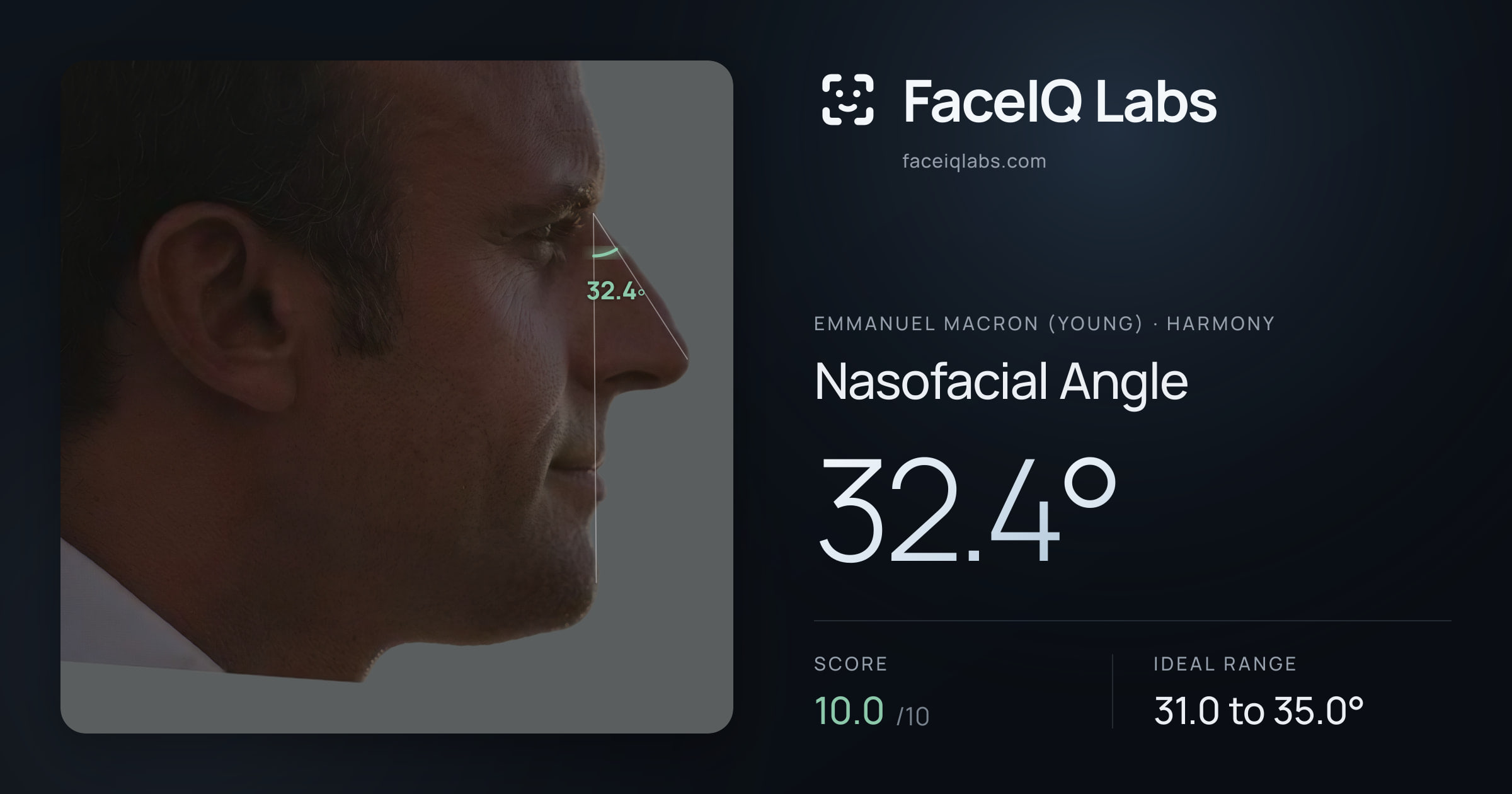 Emmanuel Macron (Young) Nasofacial Angle: 32.4°, drawn on the photo