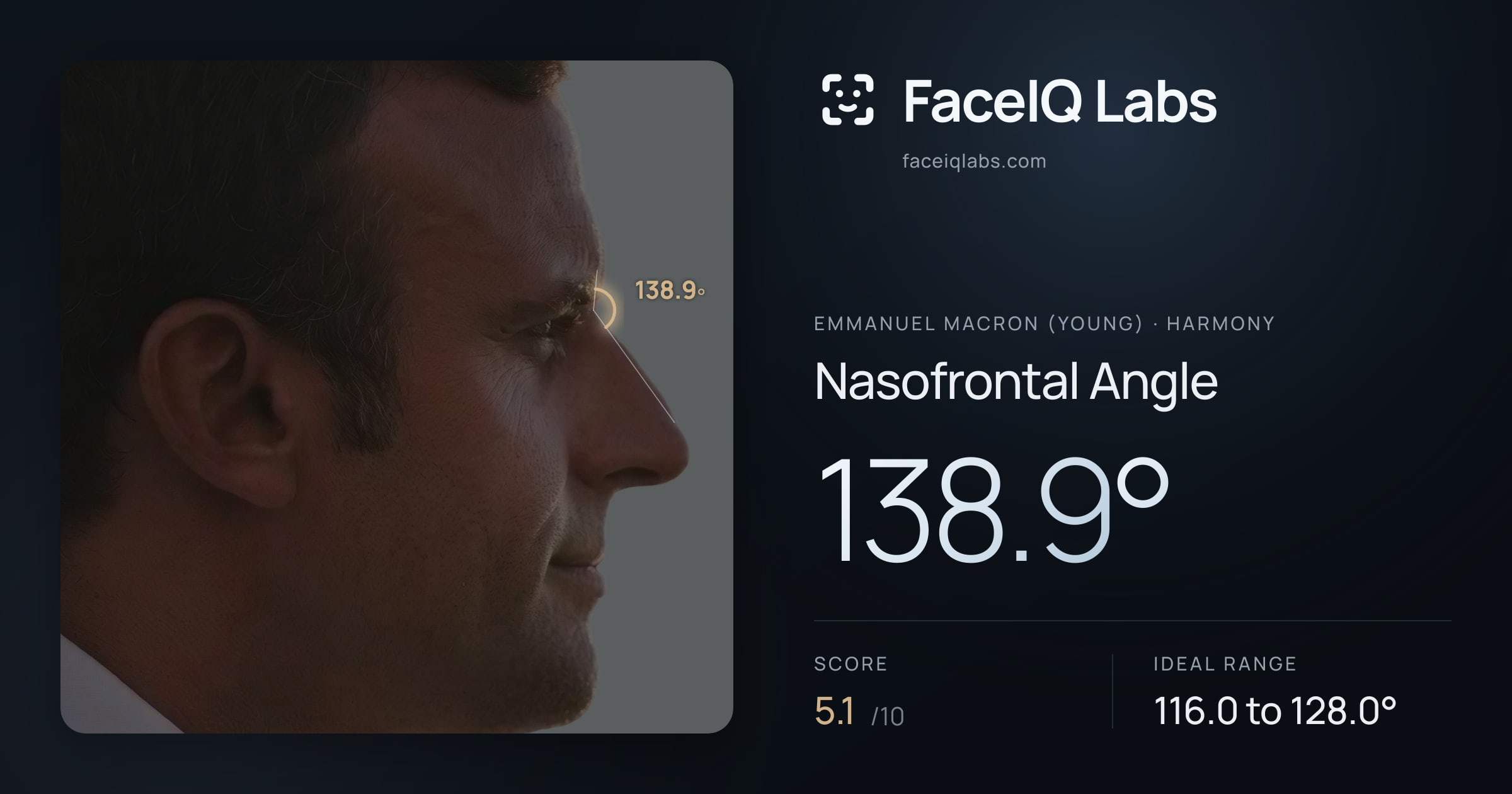 Emmanuel Macron (Young) Nasofrontal Angle: 138.9°, drawn on the photo