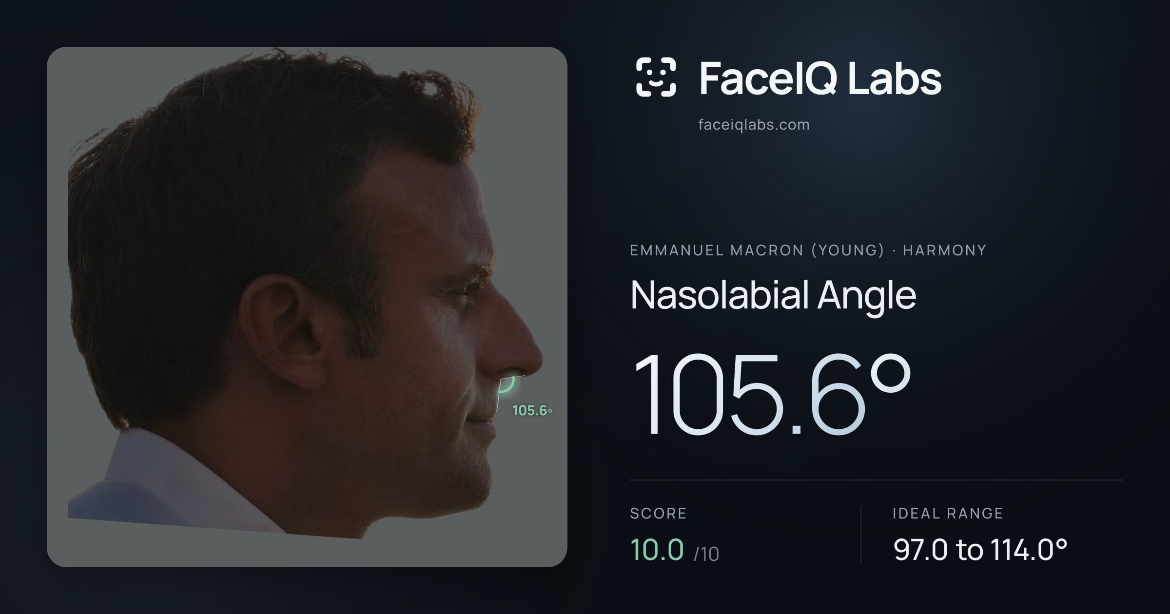 Emmanuel Macron (Young) Nasolabial Angle: 105.6°, drawn on the photo
