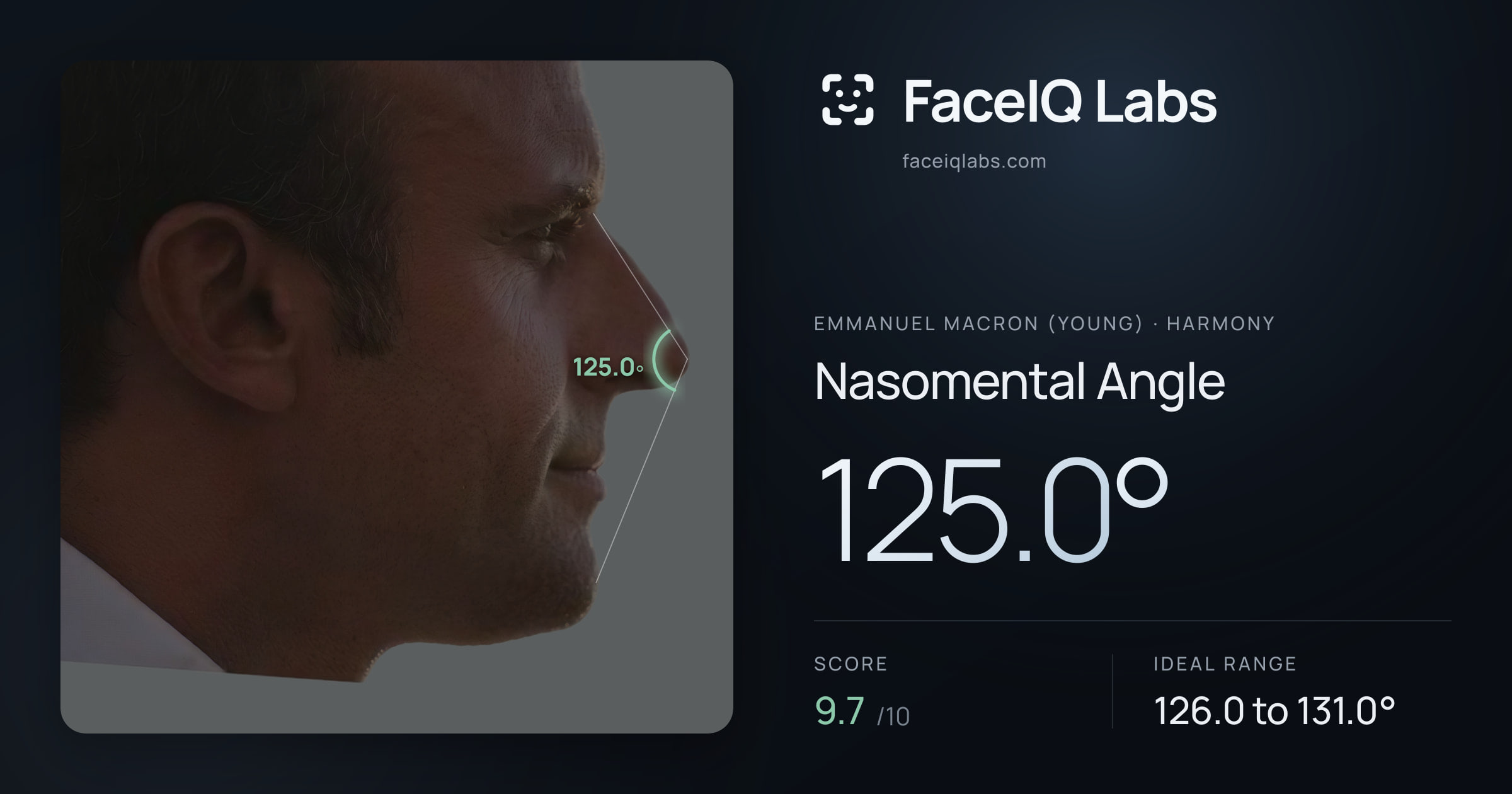 Emmanuel Macron (Young) Nasomental Angle: 125.0°, drawn on the photo