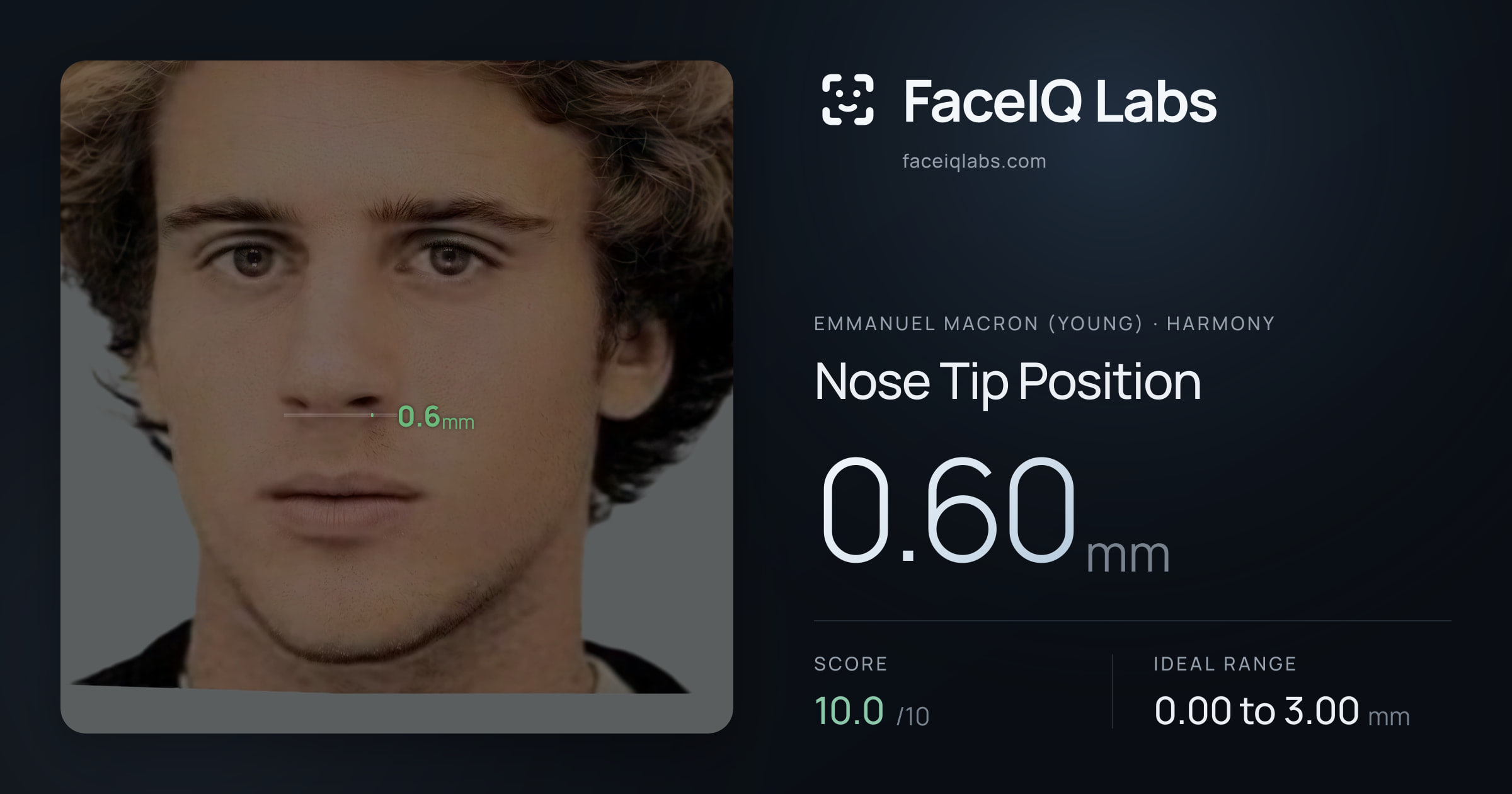 Emmanuel Macron (Young) Nose Tip Position: 0.60mm, drawn on the photo