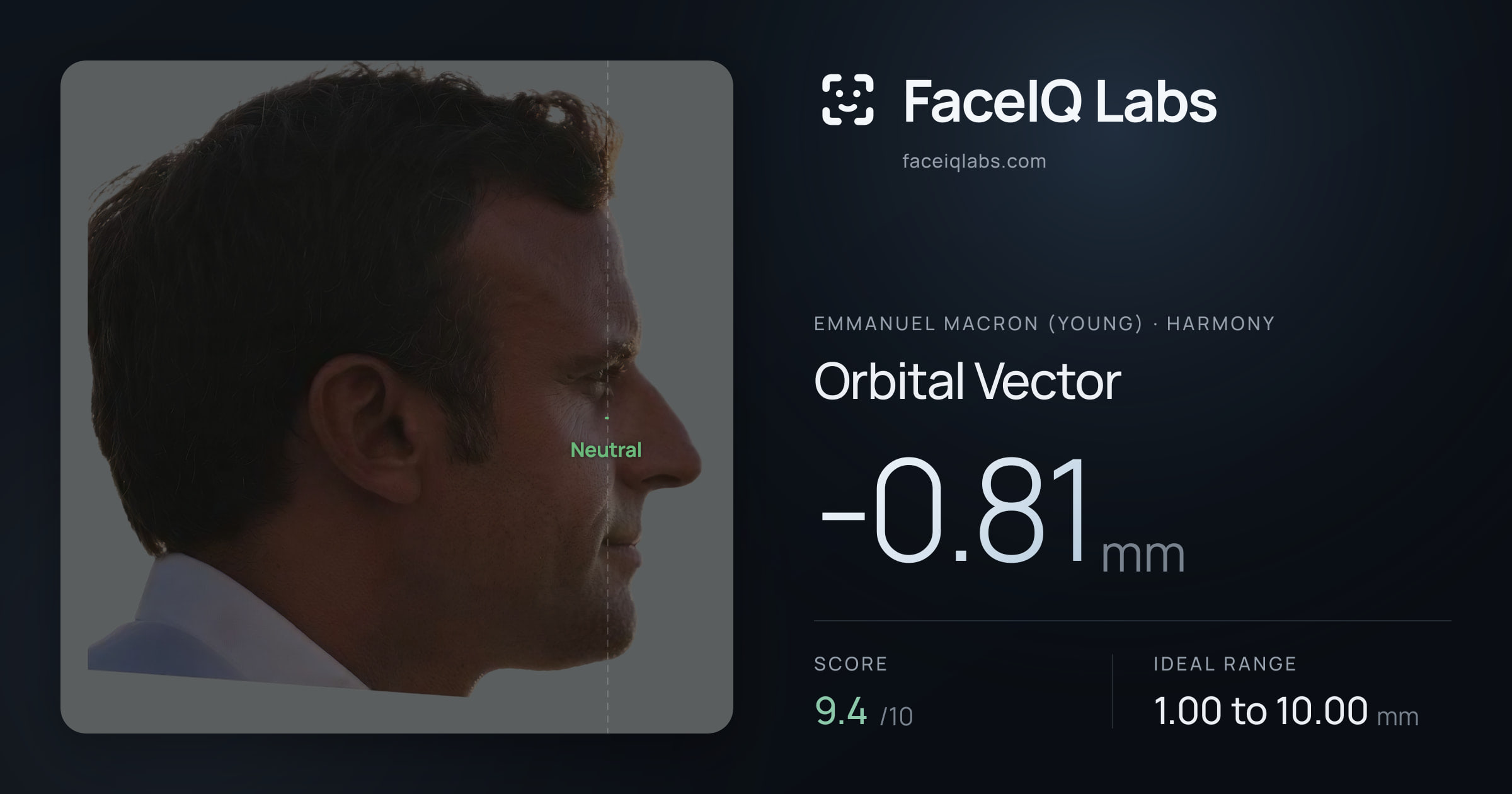 Emmanuel Macron (Young) Orbital Vector: -0.81mm, drawn on the photo