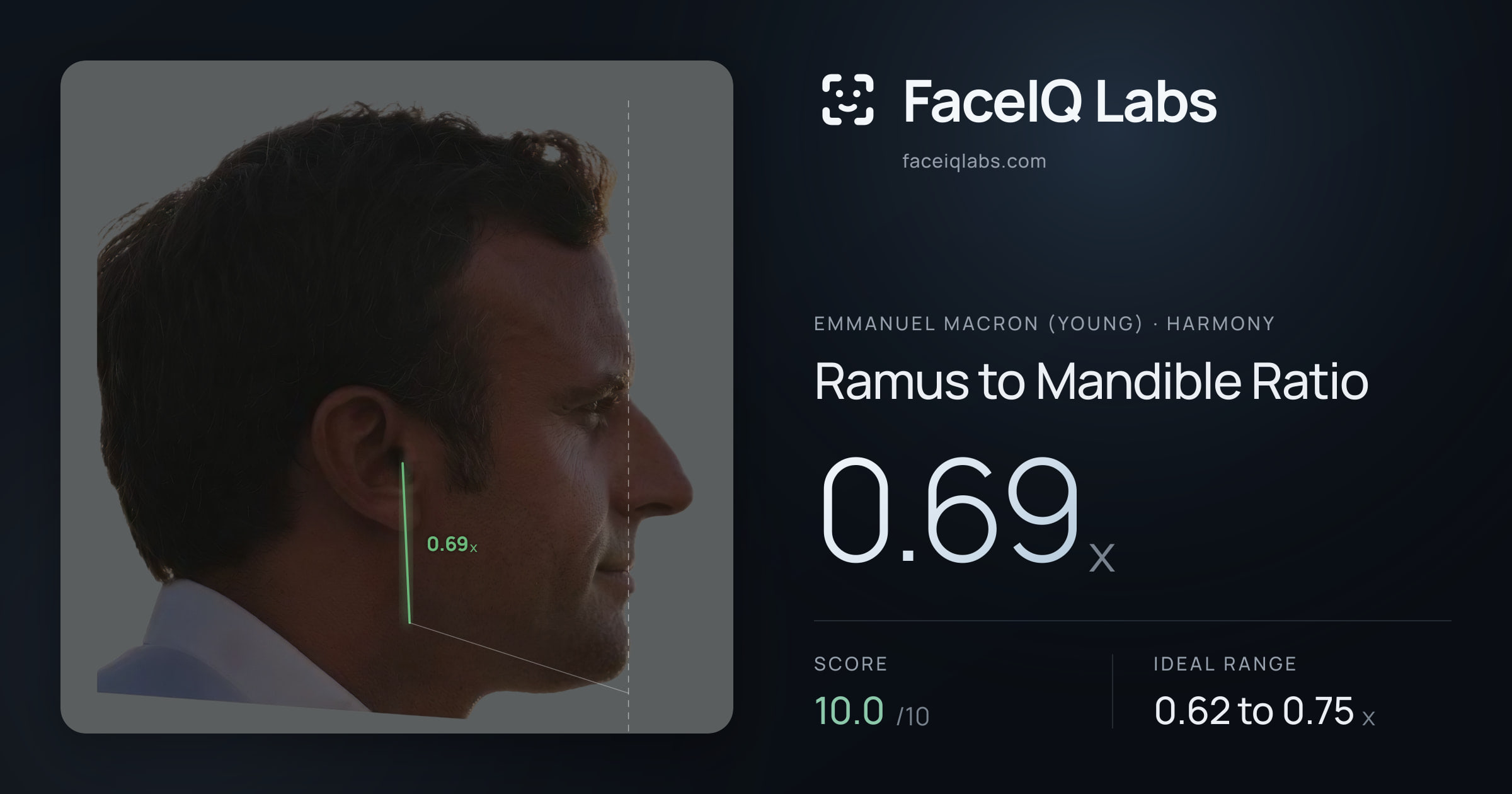 Emmanuel Macron (Young) Ramus to Mandible Ratio: 0.69x, drawn on the photo