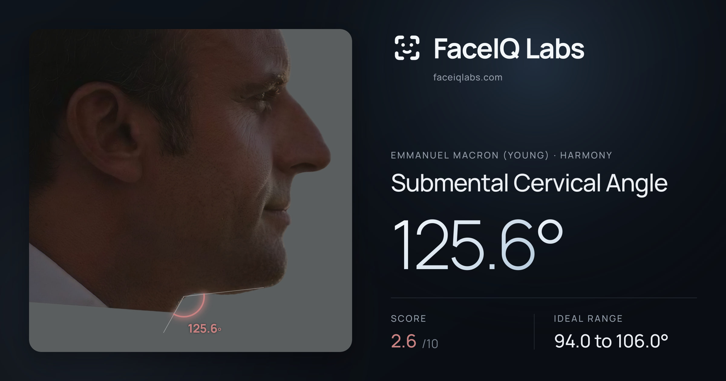 Emmanuel Macron (Young) Submental Cervical Angle: 125.6°, drawn on the photo