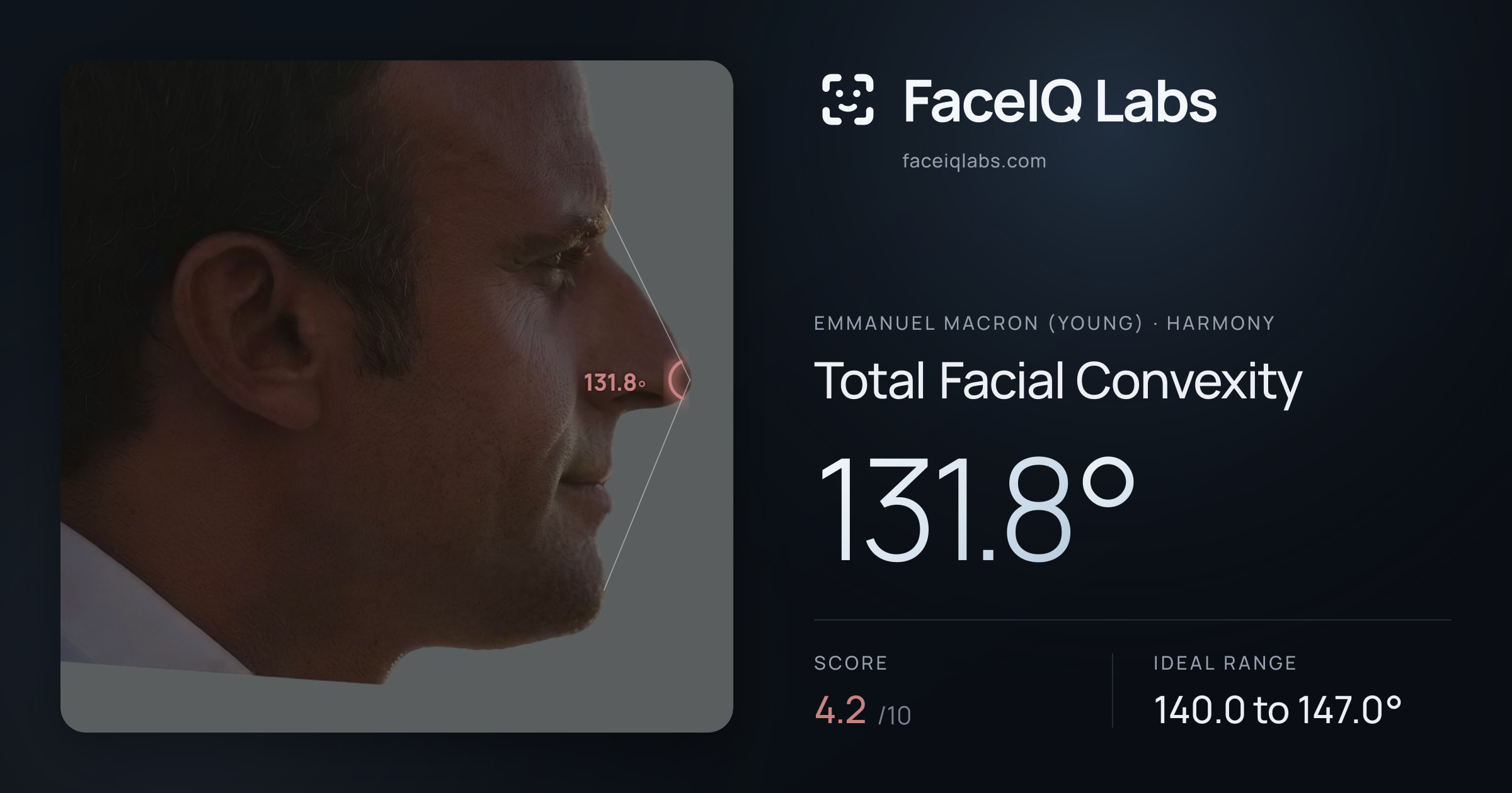 Emmanuel Macron (Young) Total Facial Convexity: 131.8°, drawn on the photo