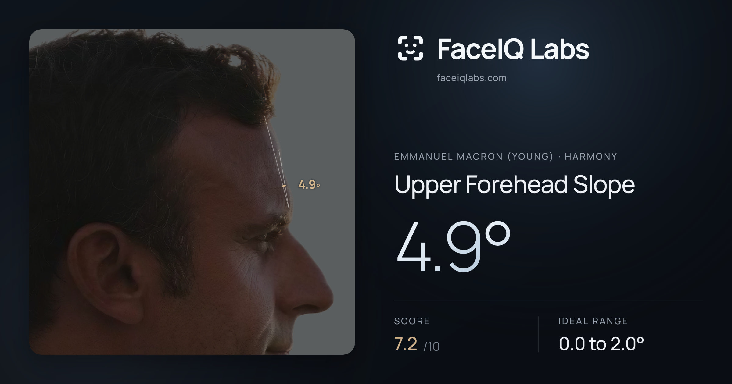 Emmanuel Macron (Young) Upper Forehead Slope: 4.9°, drawn on the photo