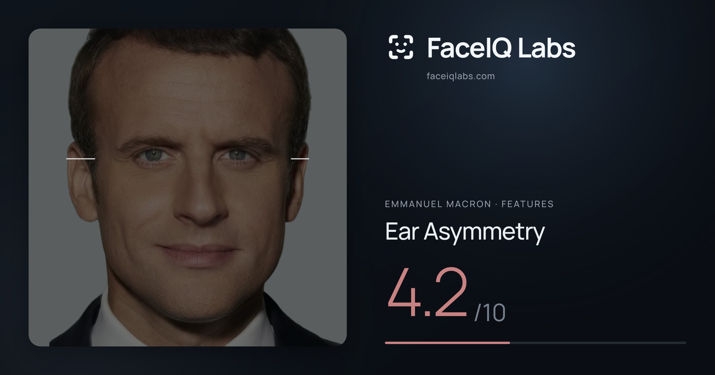 Emmanuel Macron Ear Asymmetry: 4.2/10, drawn on the photo