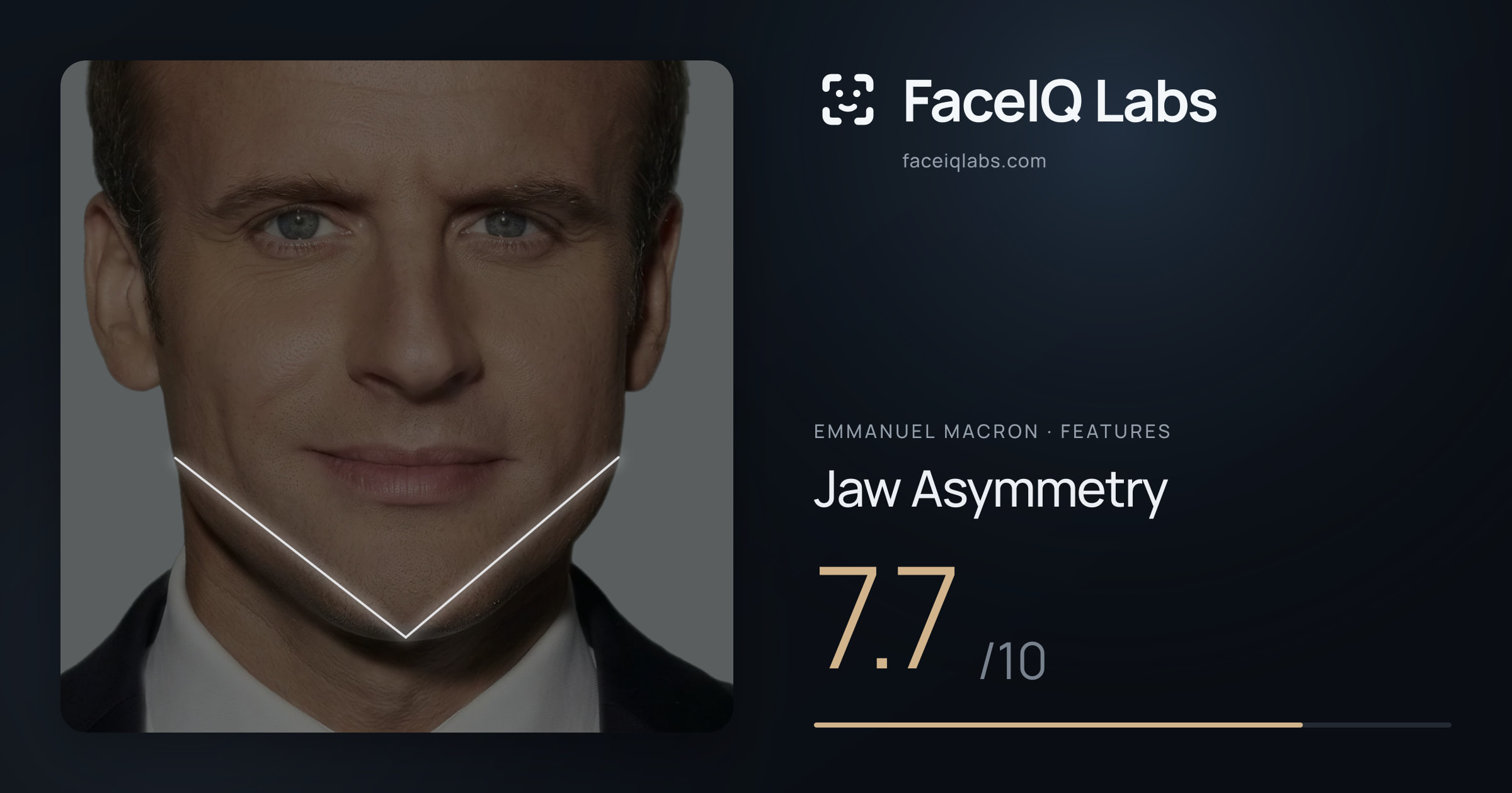 Emmanuel Macron Jaw Asymmetry: 7.7/10, drawn on the photo