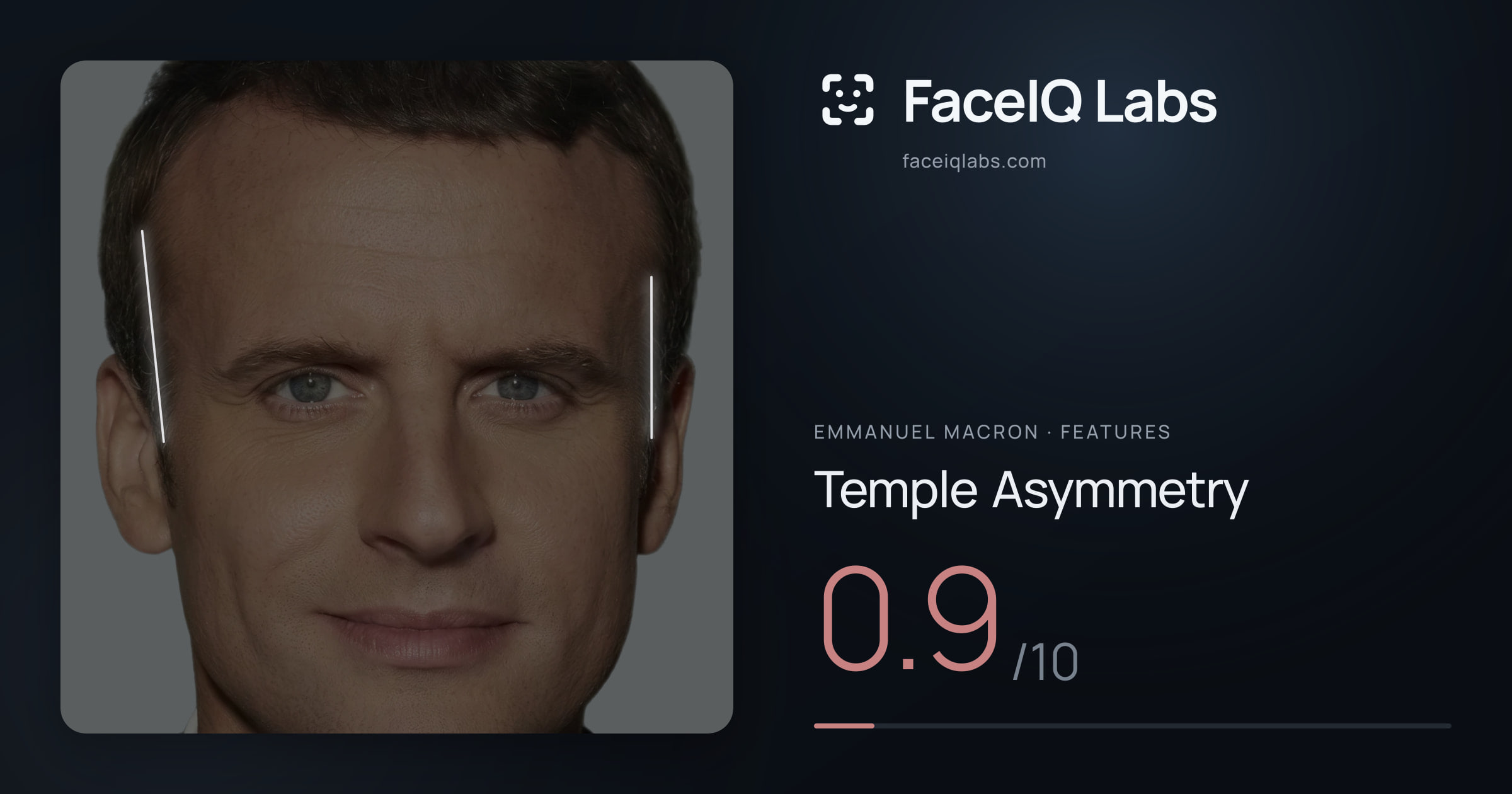 Emmanuel Macron Temple Asymmetry: 0.9/10, drawn on the photo