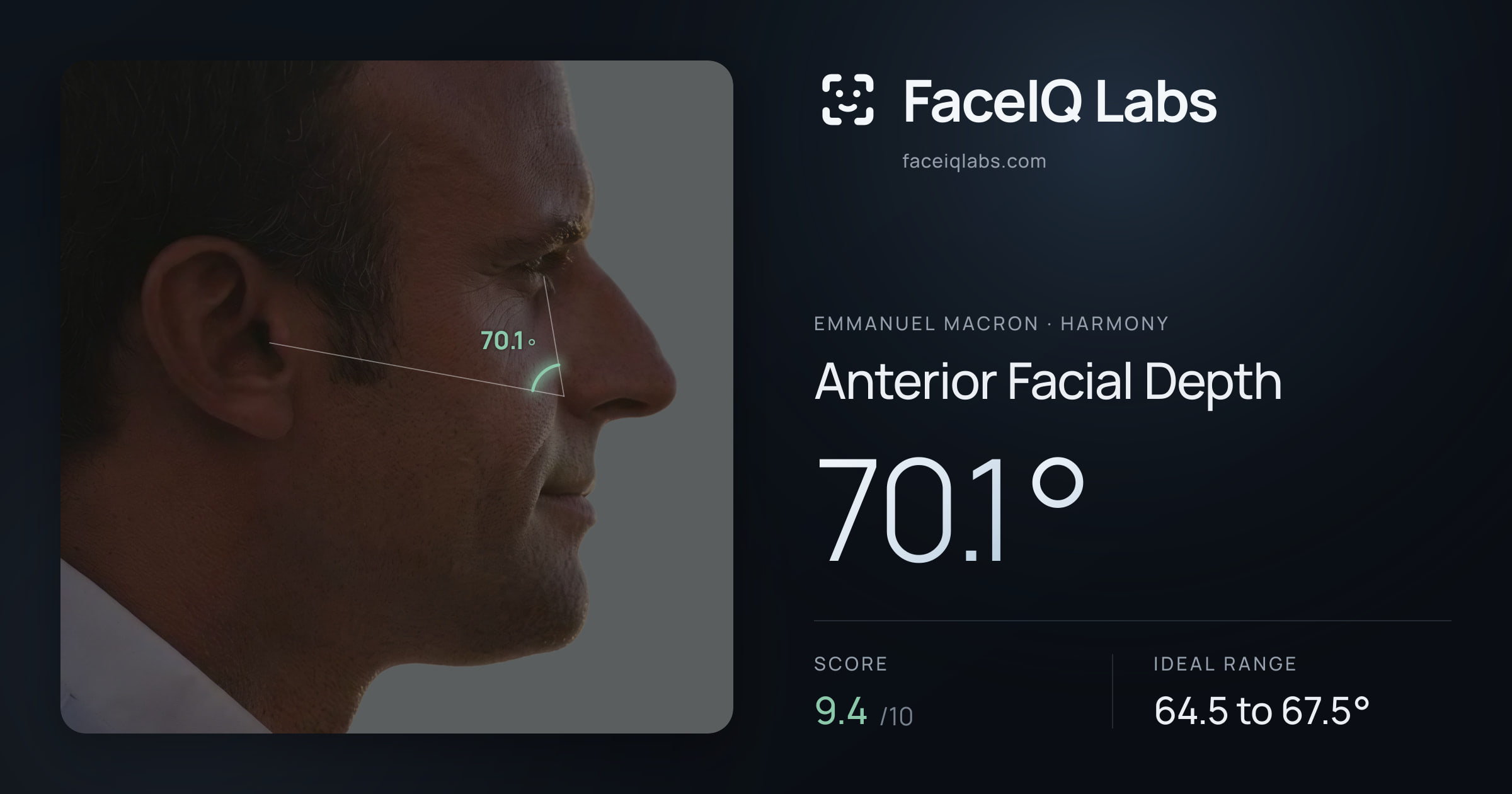 Emmanuel Macron Anterior Facial Depth: 70.1°, drawn on the photo