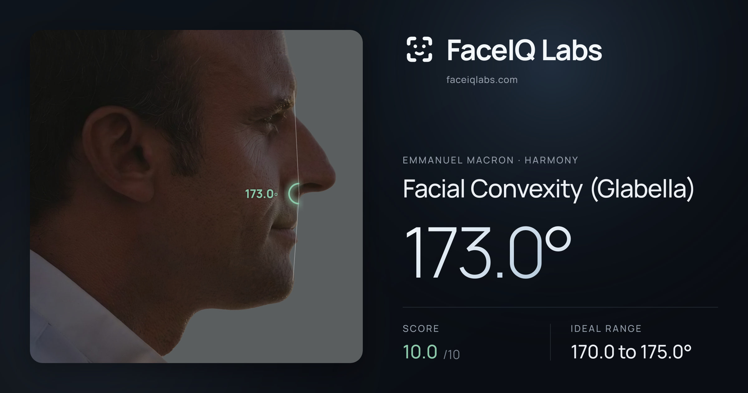 Emmanuel Macron Facial Convexity (Glabella): 173.0°, drawn on the photo