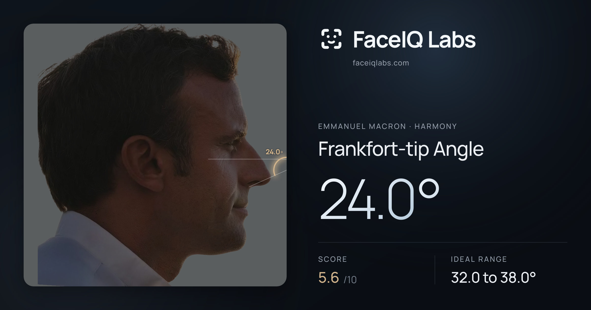 Emmanuel Macron Frankfort-tip Angle: 24.0°, drawn on the photo