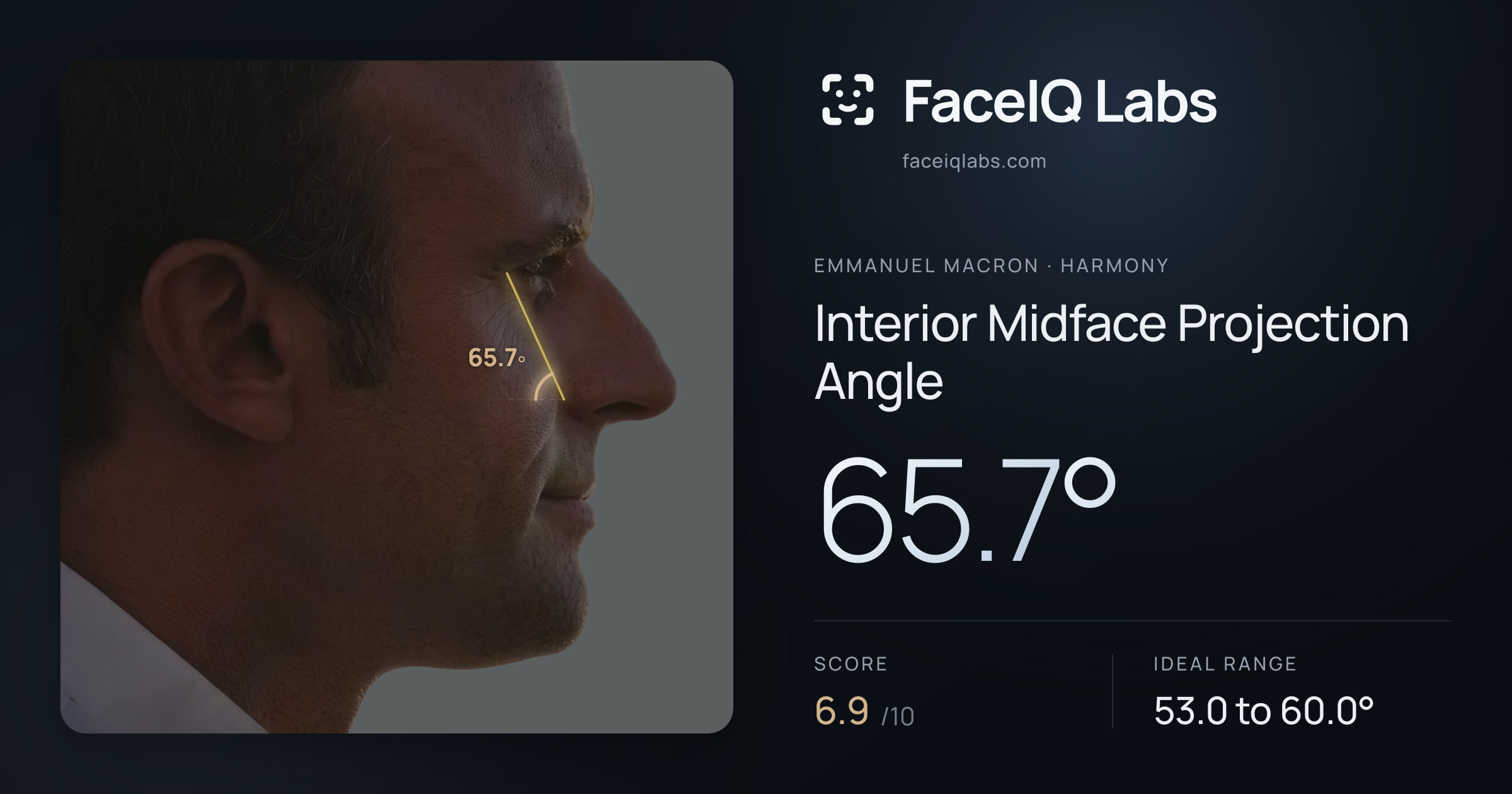 Emmanuel Macron Interior Midface Projection Angle: 65.7°, drawn on the photo