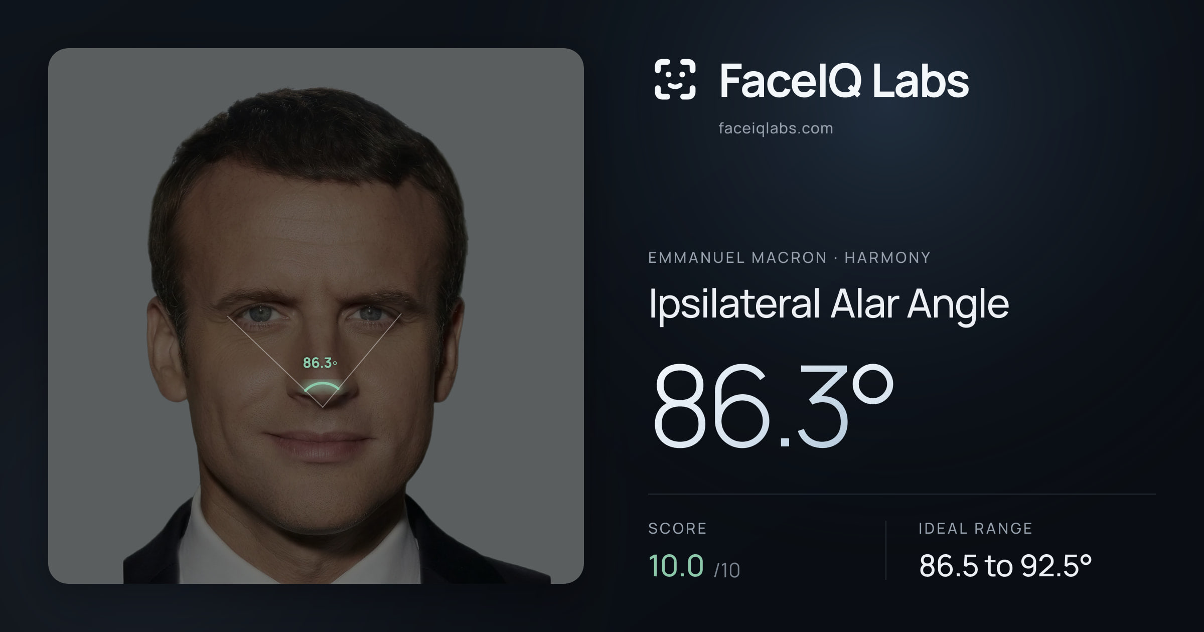Emmanuel Macron Ipsilateral Alar Angle: 86.3°, drawn on the photo