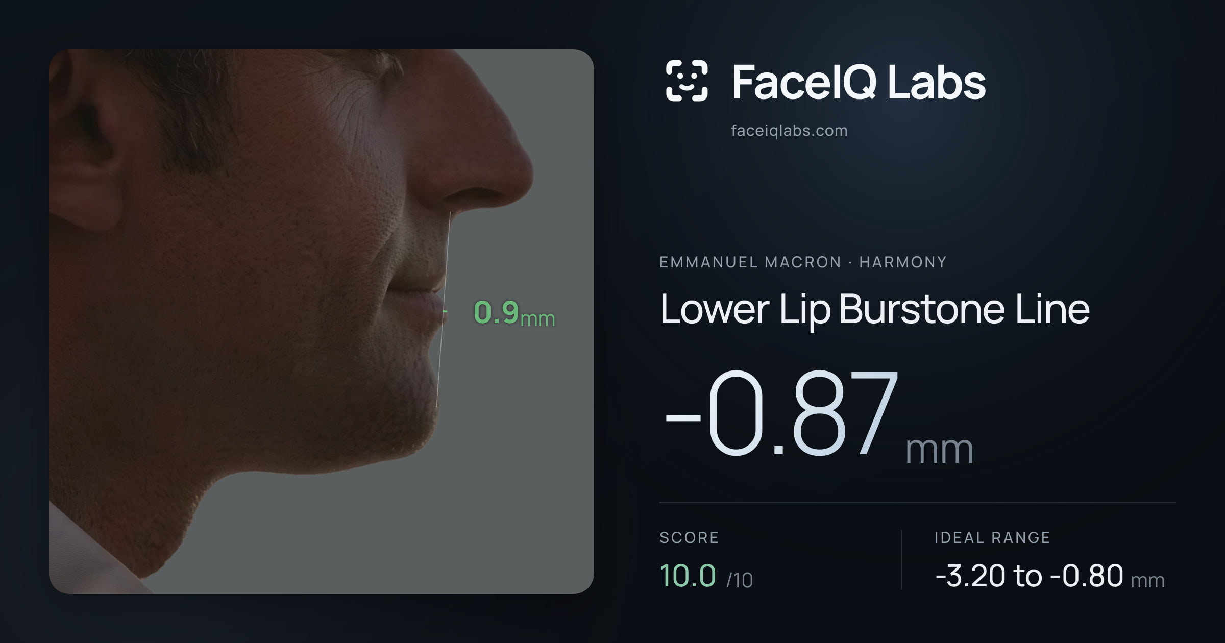 Emmanuel Macron Lower Lip Burstone Line: -0.87mm, drawn on the photo