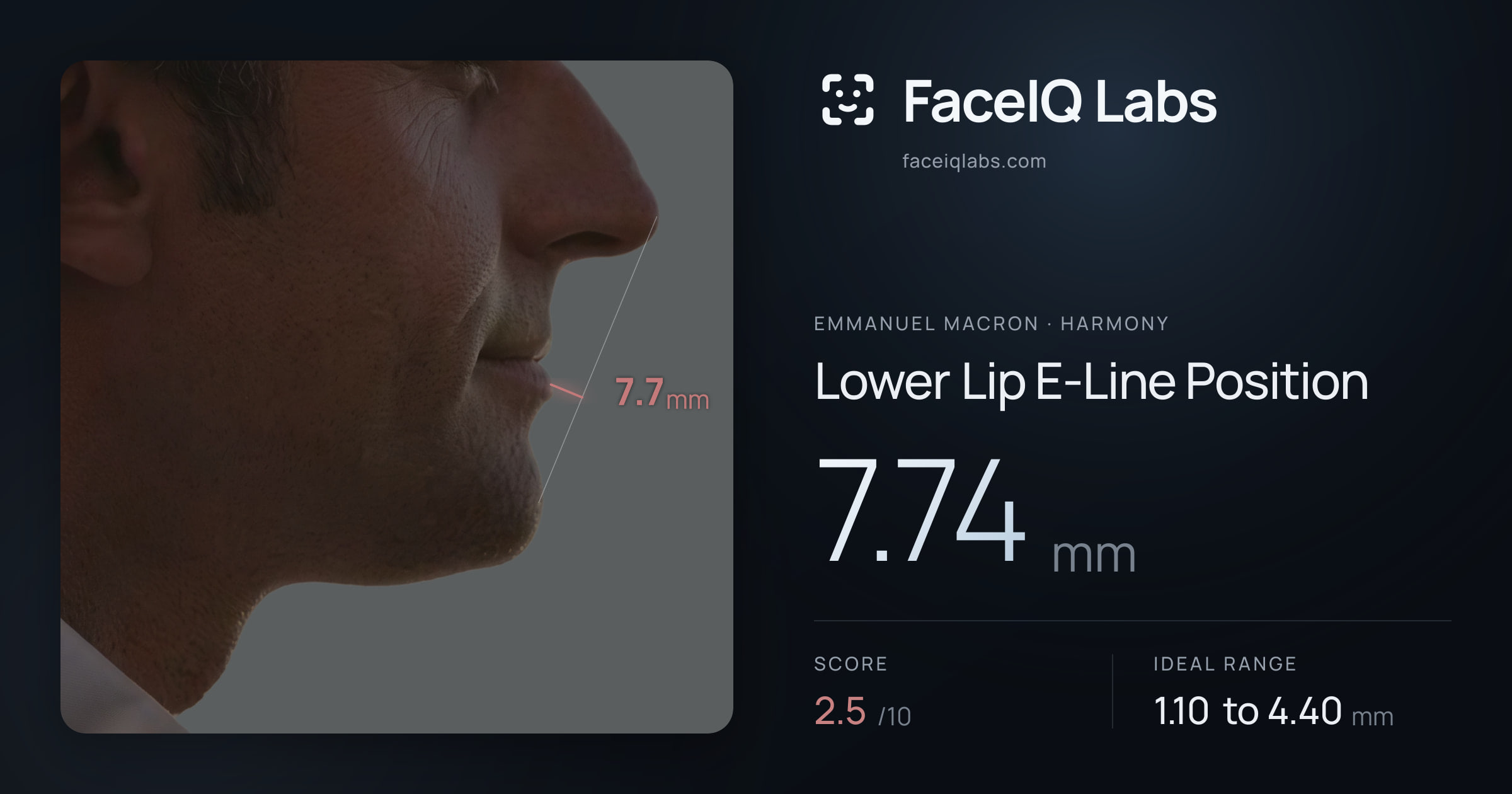 Emmanuel Macron Lower Lip E-Line Position: 7.74mm, drawn on the photo