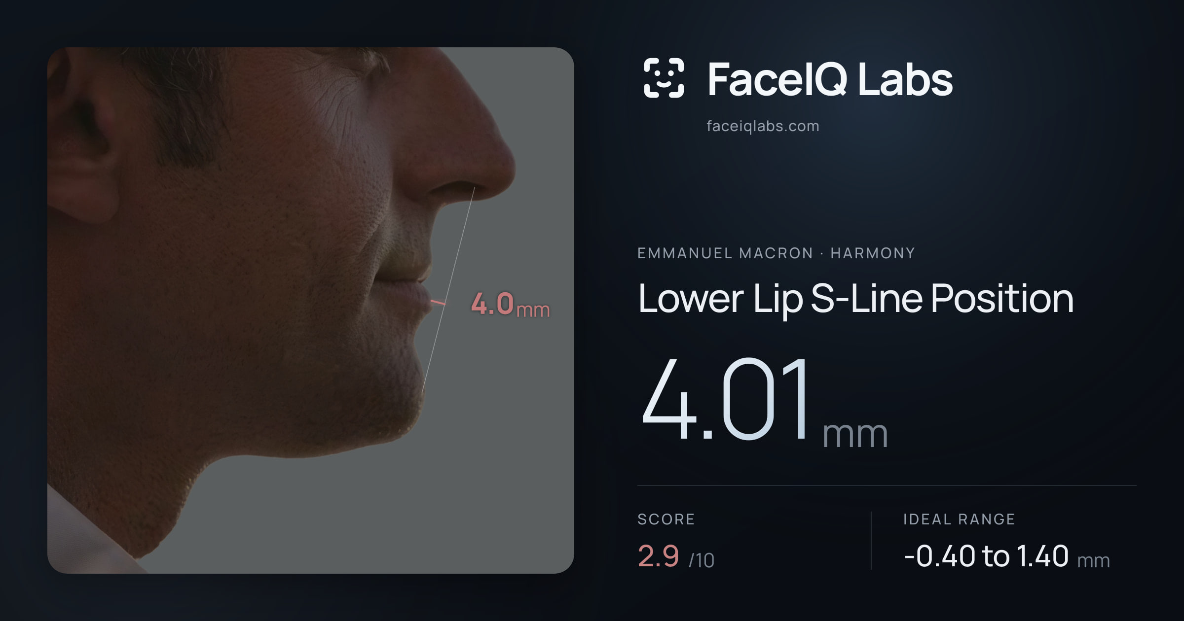 Emmanuel Macron Lower Lip S-Line Position: 4.01mm, drawn on the photo