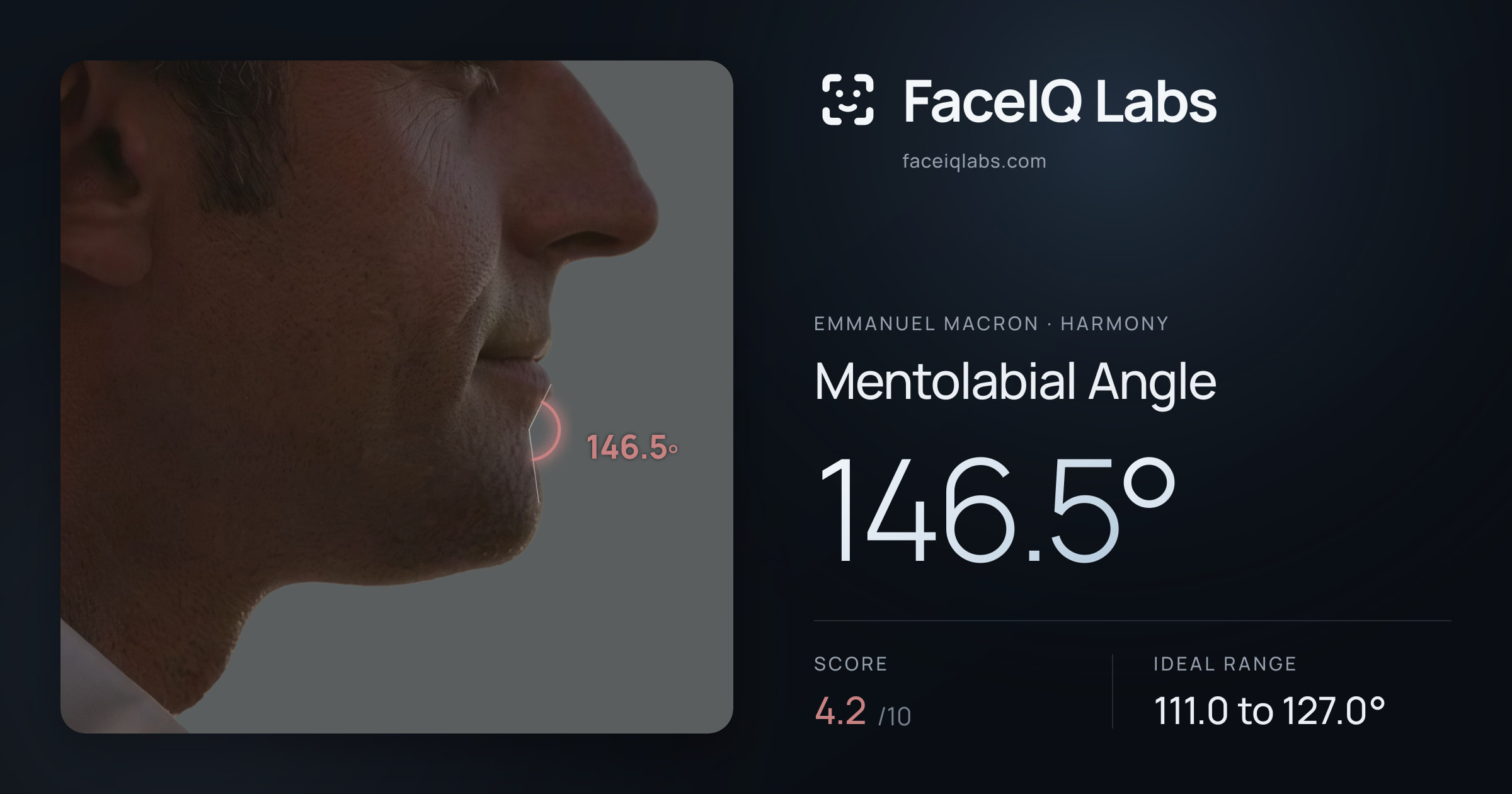 Emmanuel Macron Mentolabial Angle: 146.5°, drawn on the photo