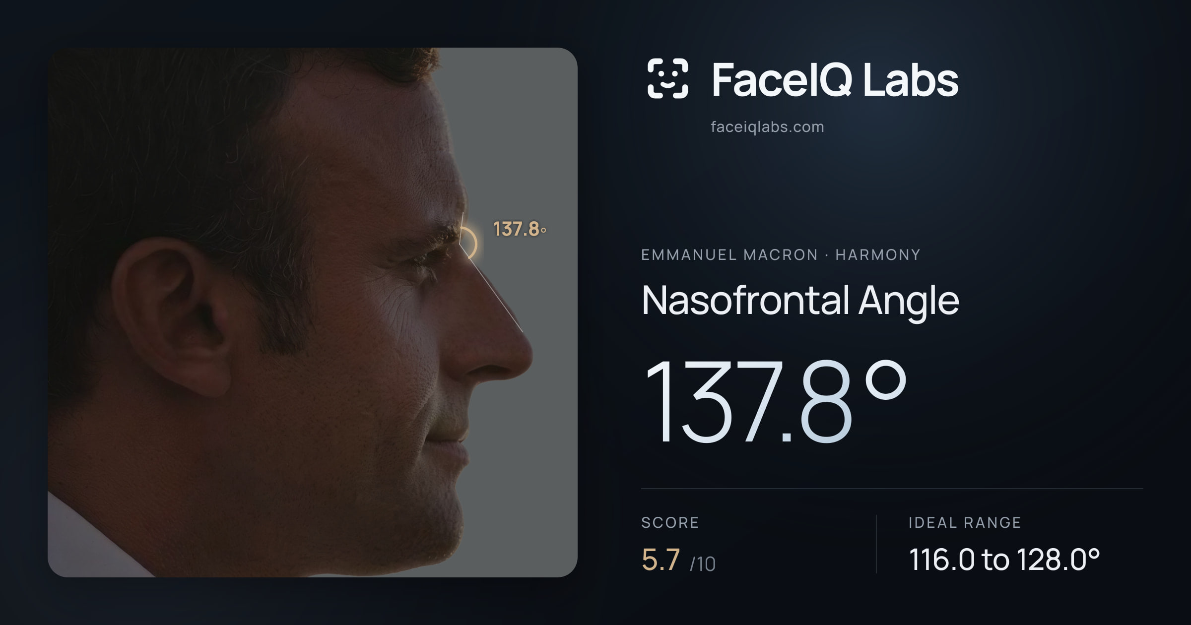 Emmanuel Macron Nasofrontal Angle: 137.8°, drawn on the photo
