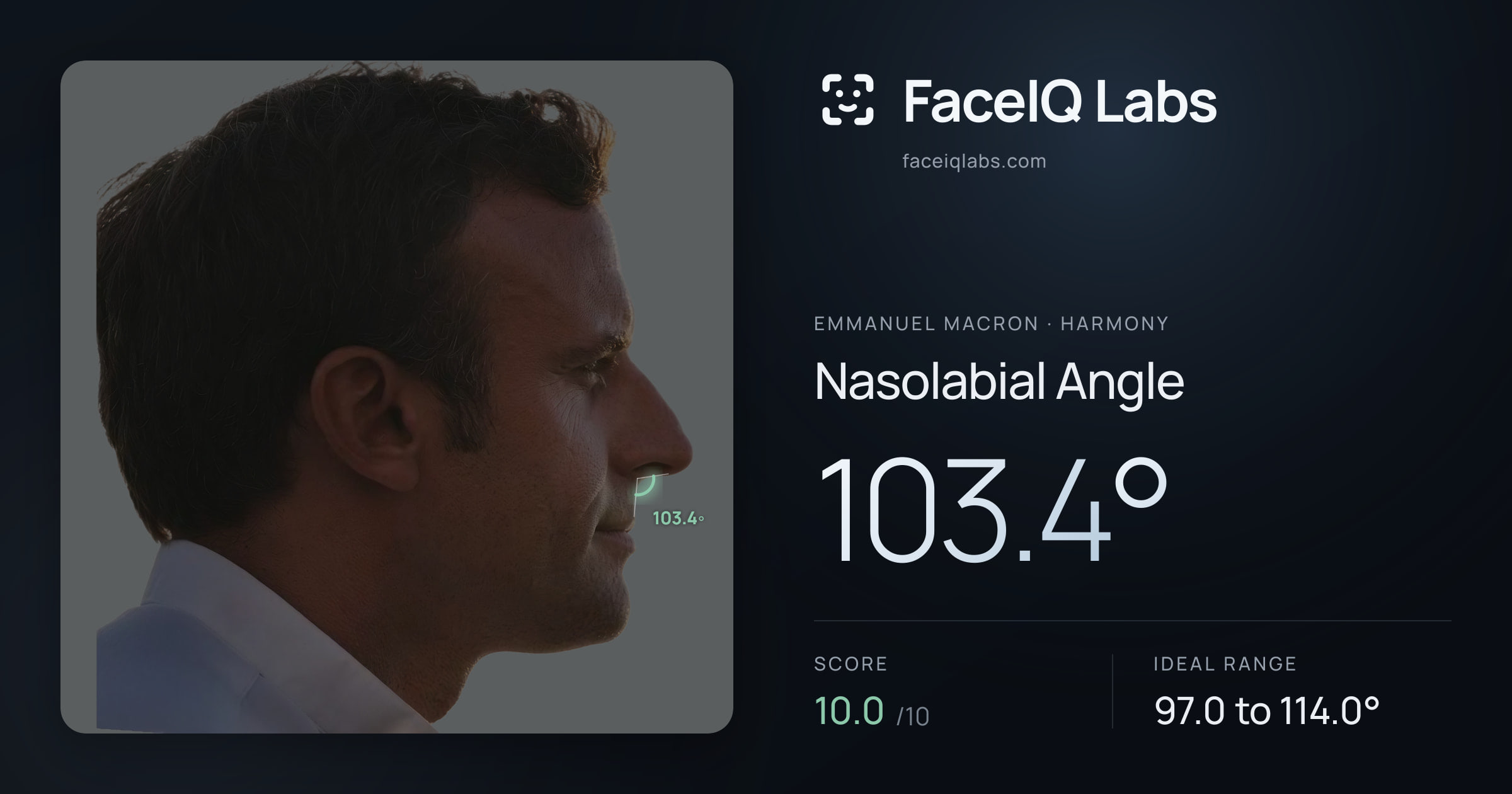 Emmanuel Macron Nasolabial Angle: 103.4°, drawn on the photo