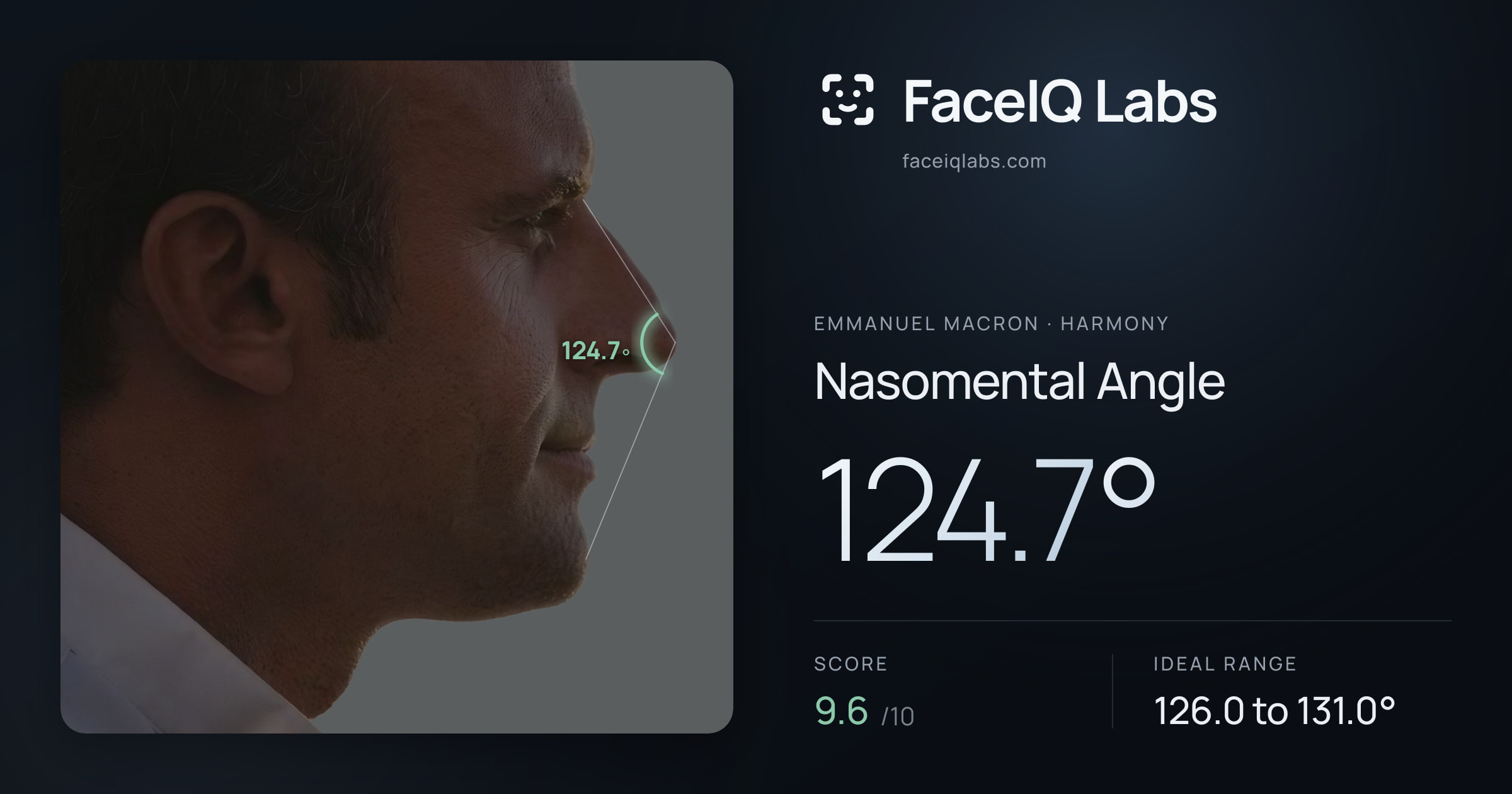 Emmanuel Macron Nasomental Angle: 124.7°, drawn on the photo