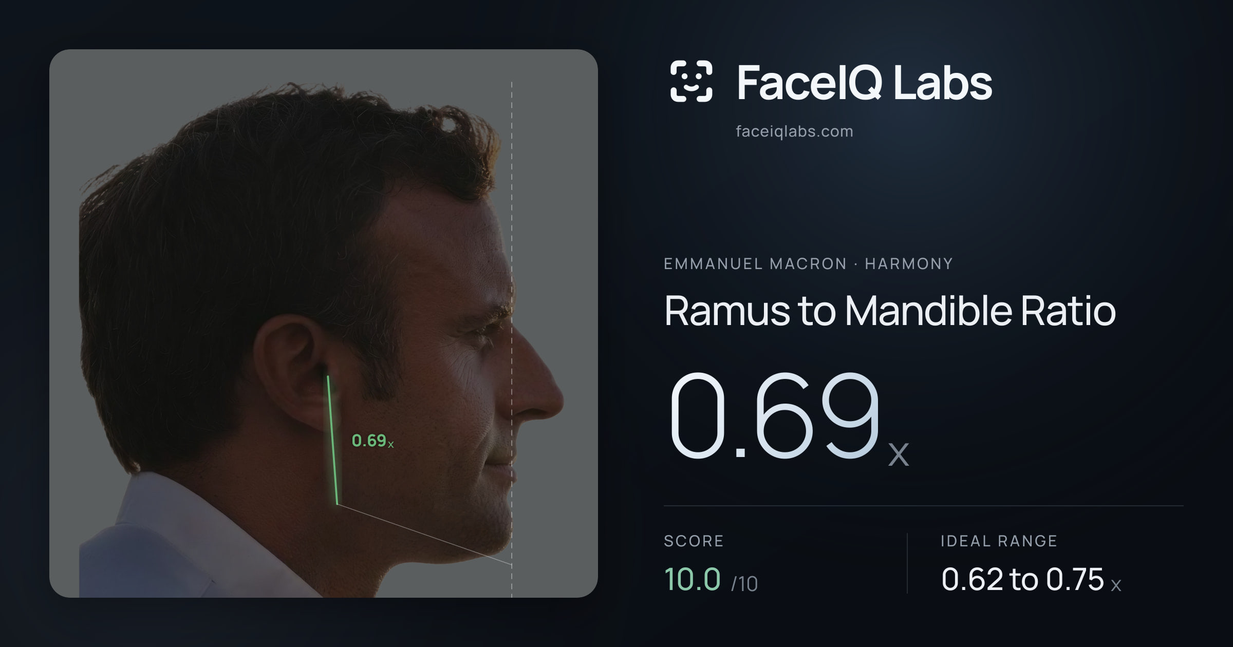 Emmanuel Macron Ramus to Mandible Ratio: 0.69x, drawn on the photo